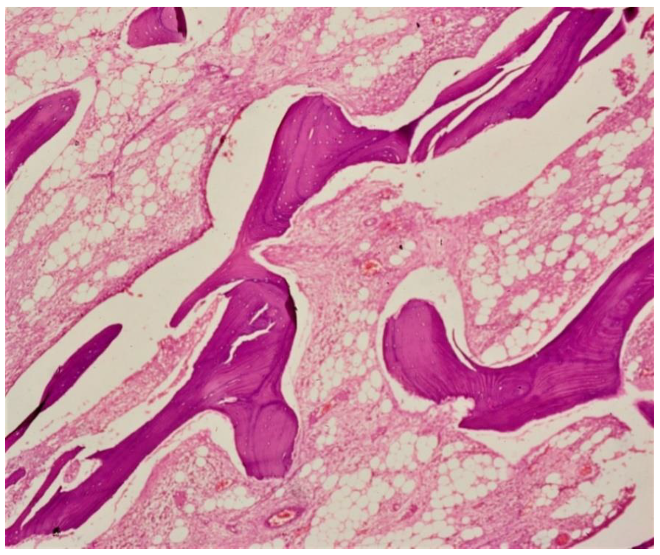Microorganisms Free Full Text The Impact Of Tick Borne Diseases On The Bone Html