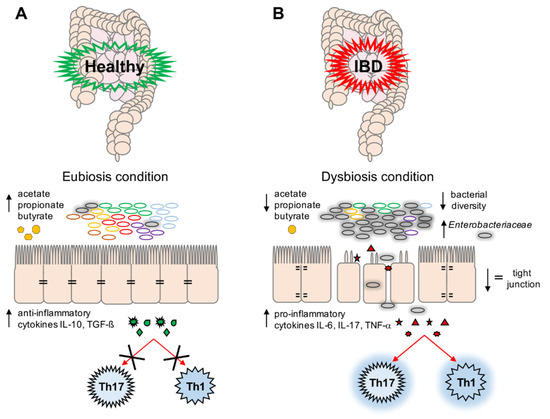 dysbiosis ibd