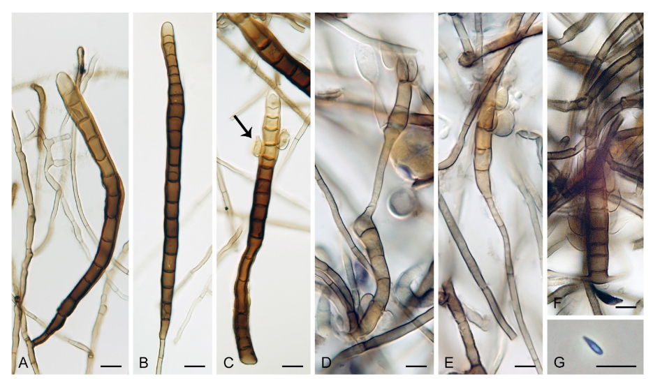 Microorganisms 09 00706 g013