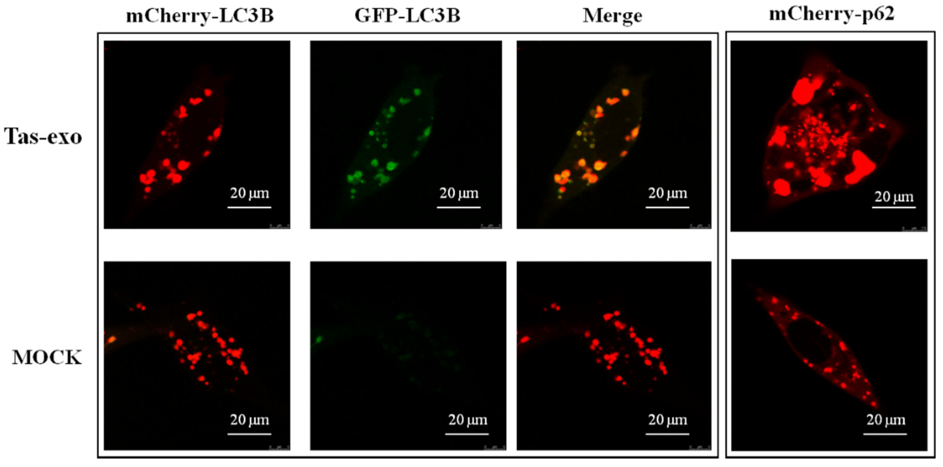 Microorganisms 09 00994 g007