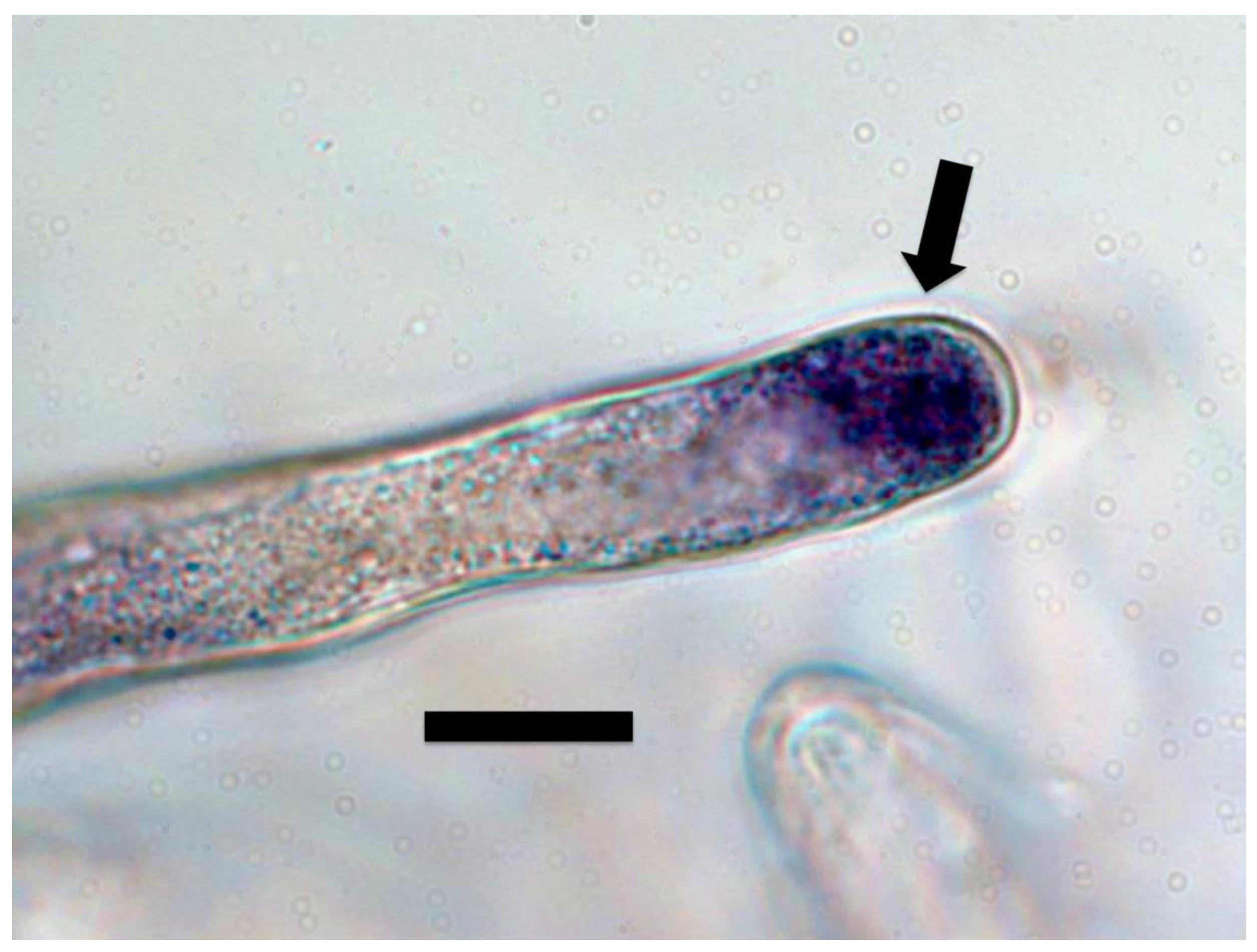 Microorganisms Free Full Text Chemical Interactions At The Interface Of Plant Root Hair Cells And Intracellular Bacteria Html