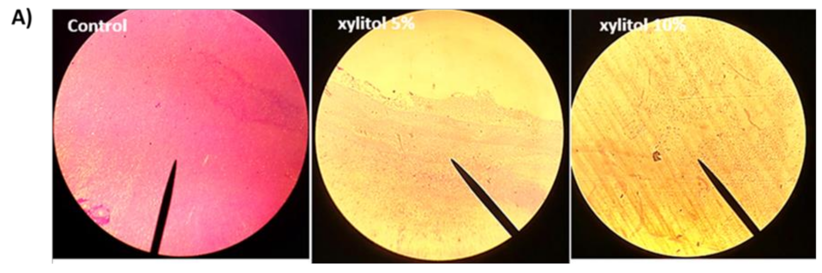xylitol dysbiosis