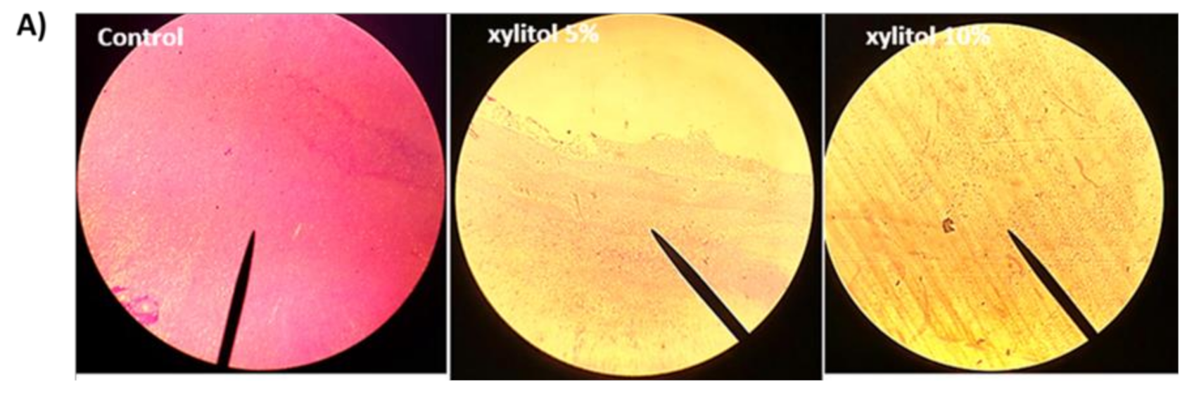 xylitol dysbiosis da pastile viermilor dimineata sau