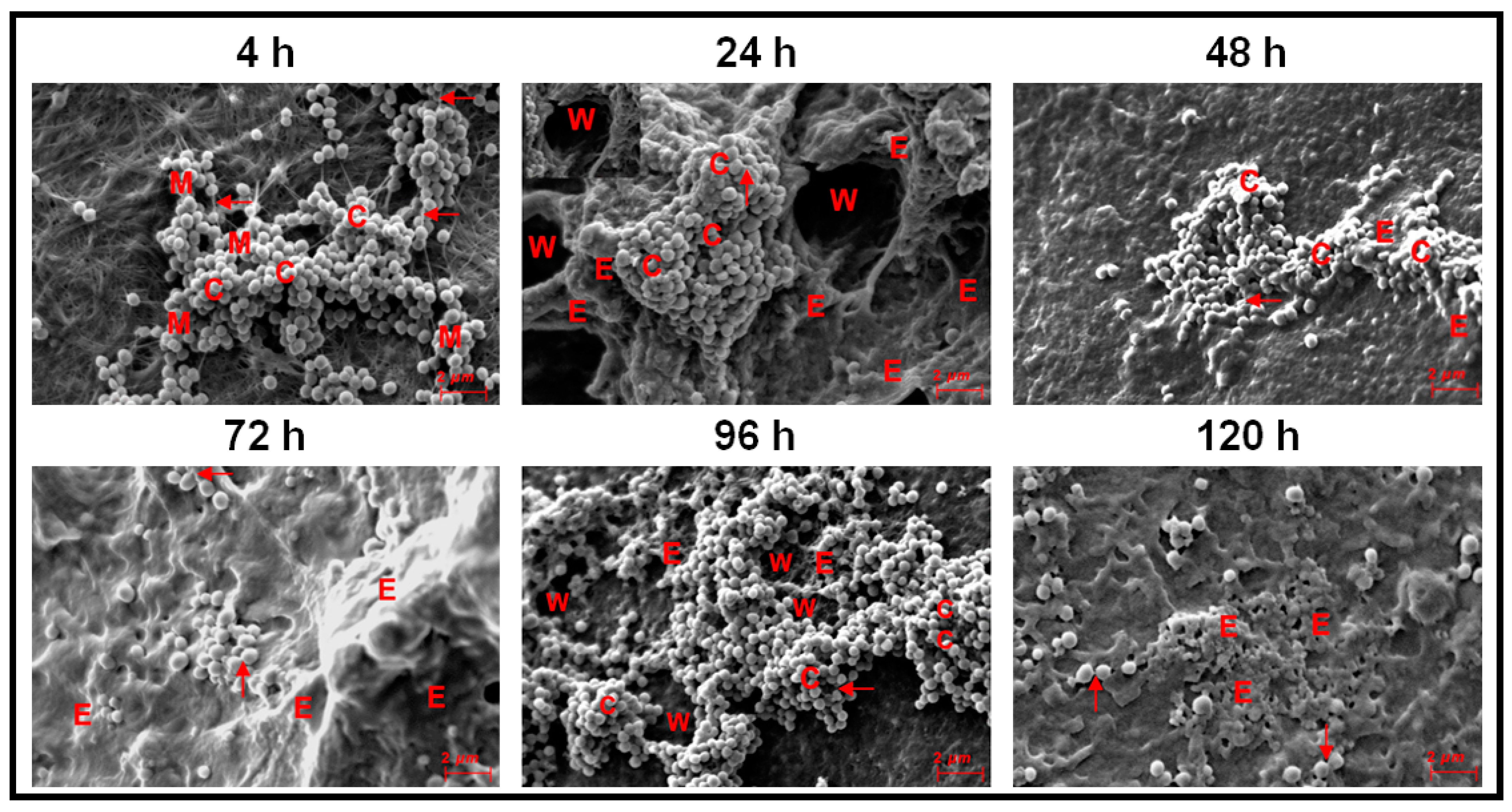 Microorganisms 09 01124 g005