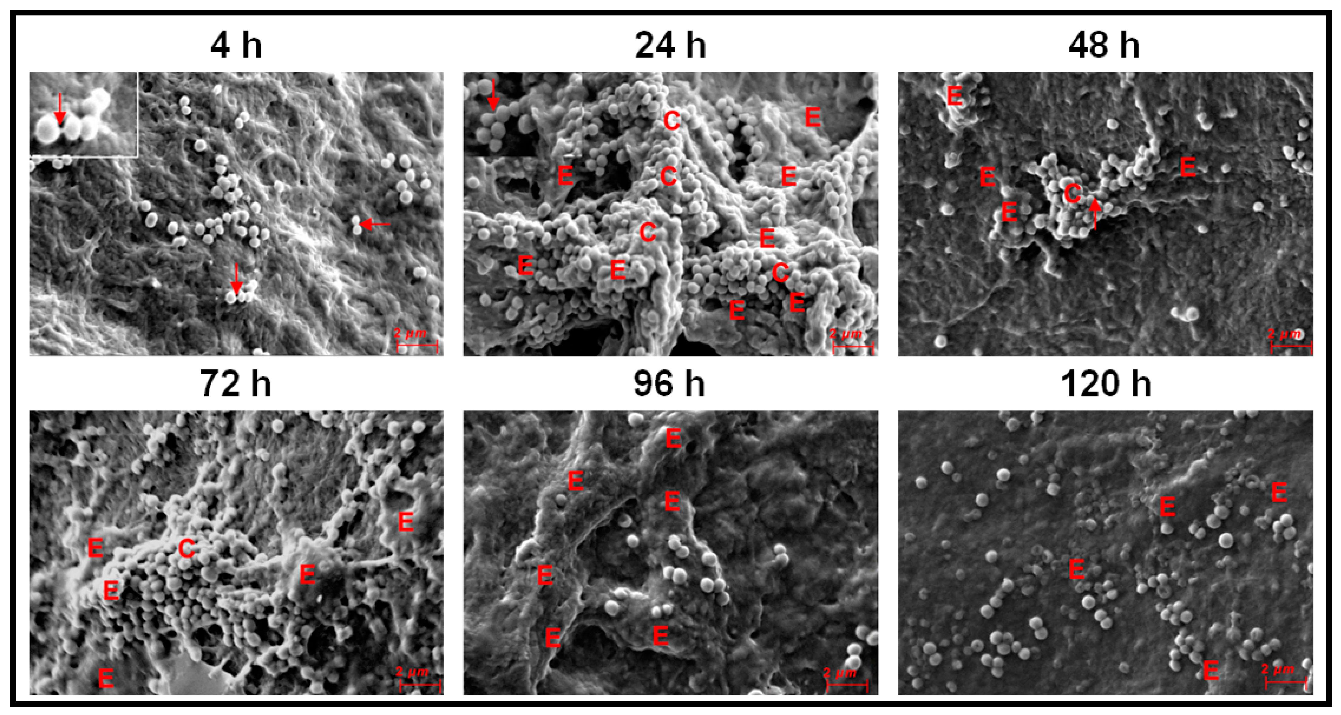 Microorganisms 09 01124 g006
