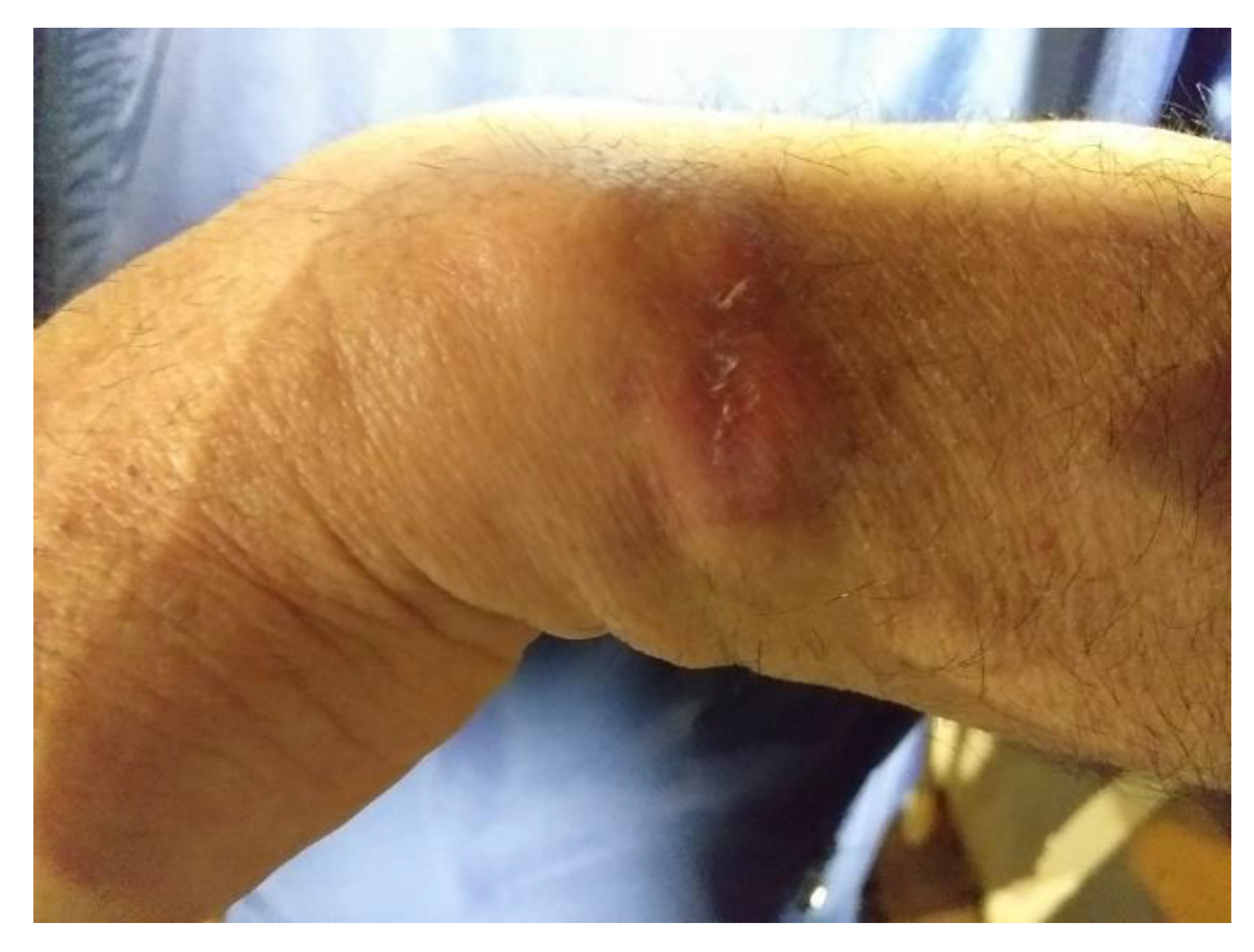 Microorganisms 09 01147 g001