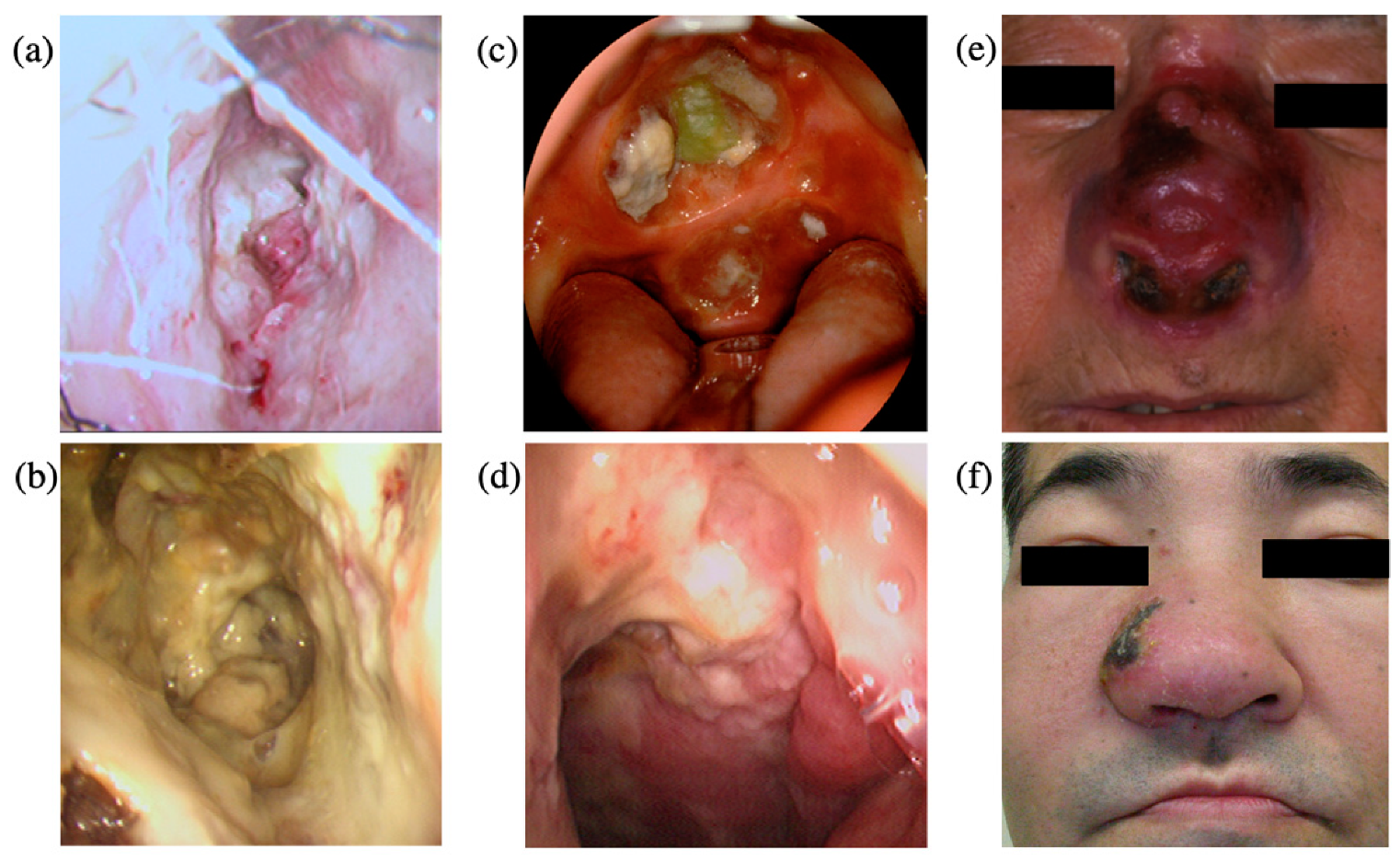 Microorganisms 09 01381 g001 Microorganisms 09 01381 g001