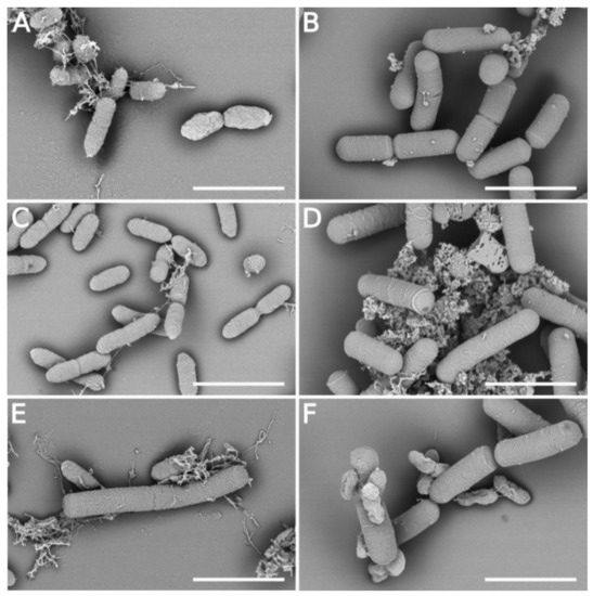 Killing Effect of Bacillus velezensis FZB42 on a Xanthomonas