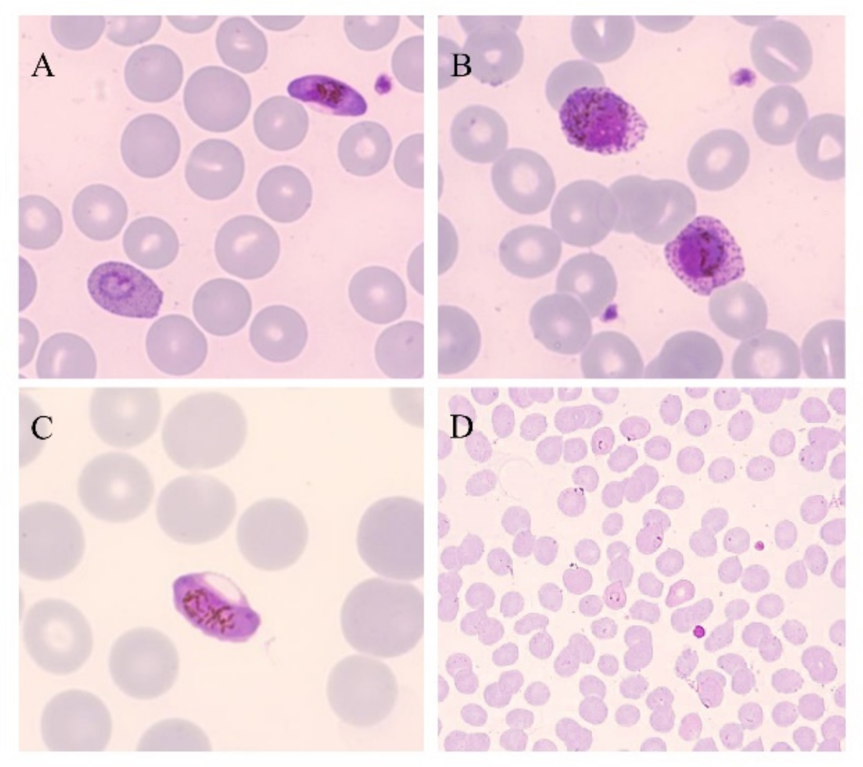 Plasmodium vivax schizont