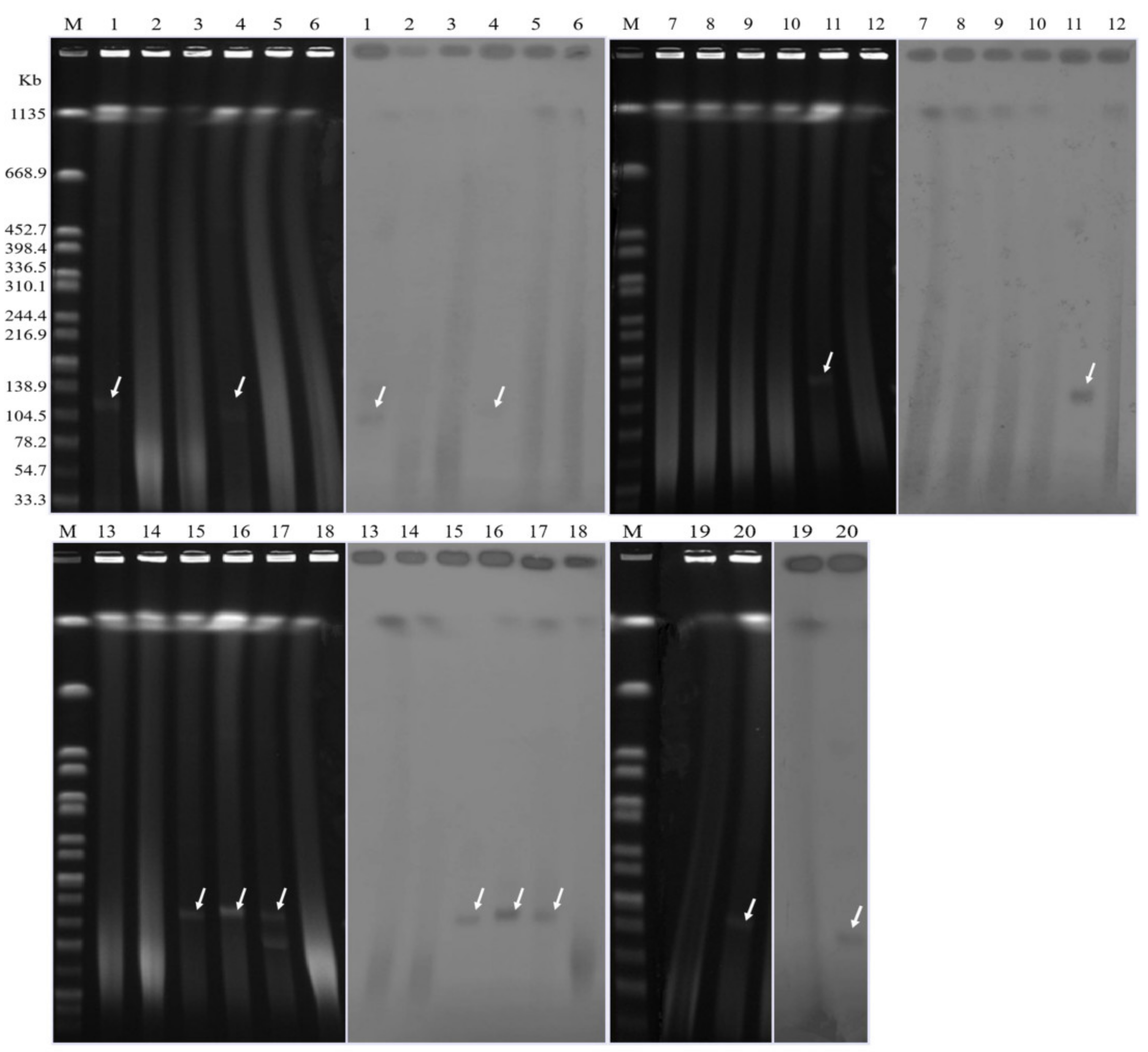 Characterization of NDM-1-Producing Carbapenemase in Proteus