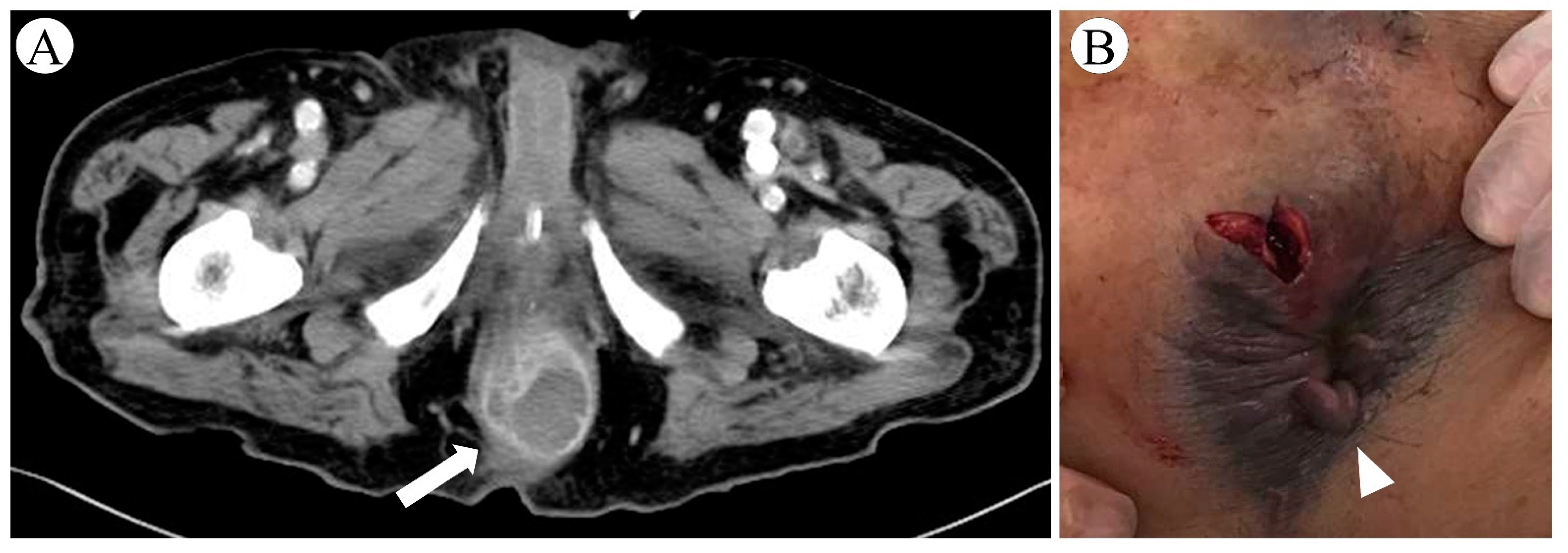 Microorganisms 10 00019 g003