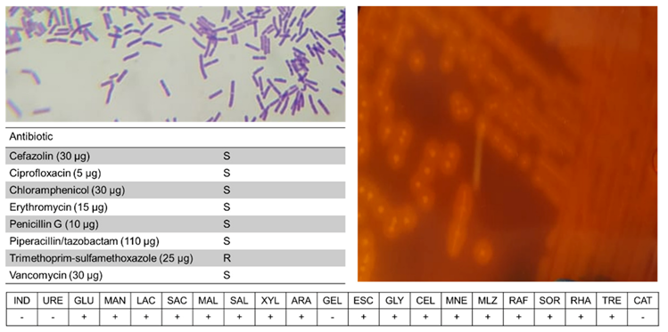 Microorganisms 10 00213 g006 Microorganisms 10 00213 g006