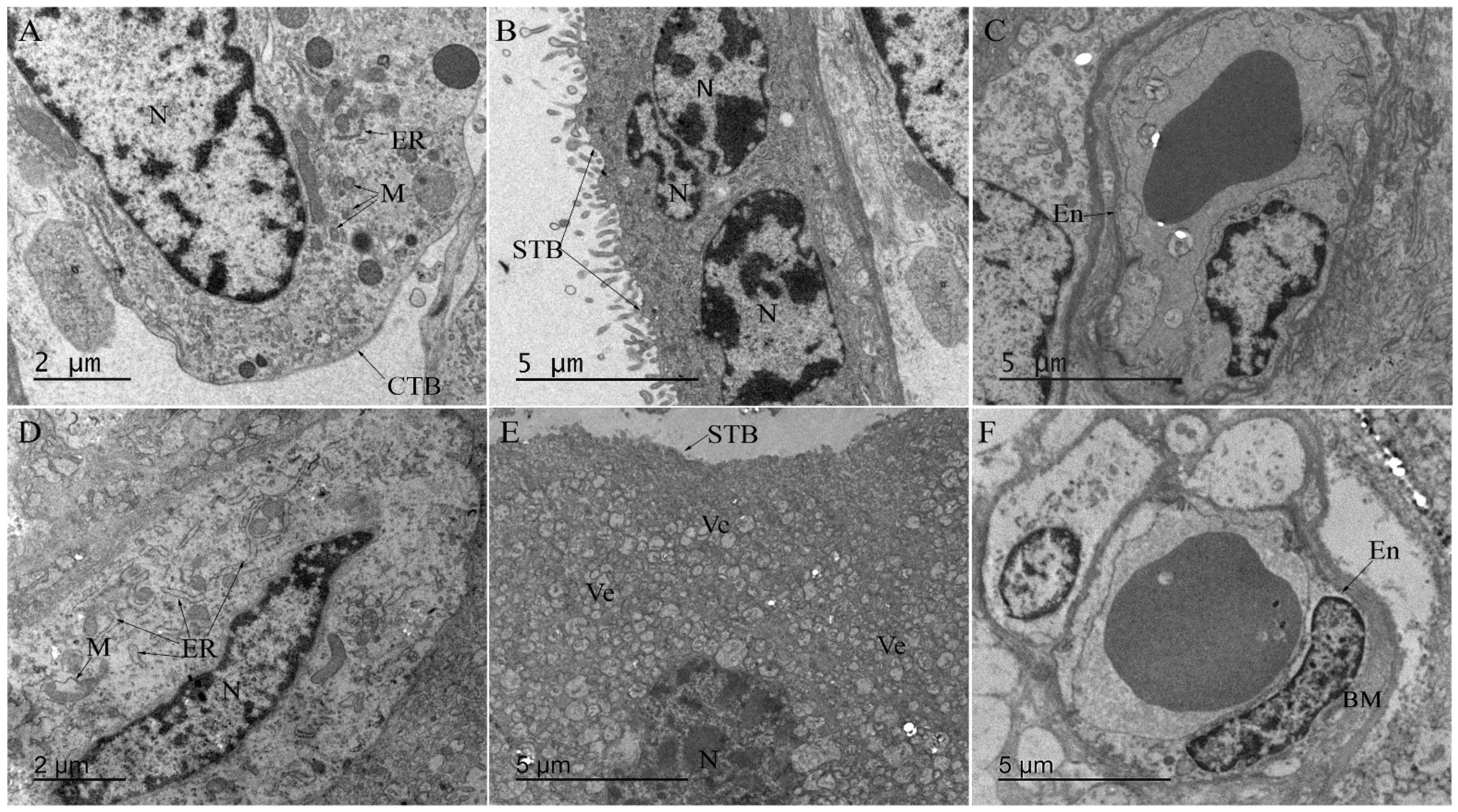 Microorganisms 10 00872 g004