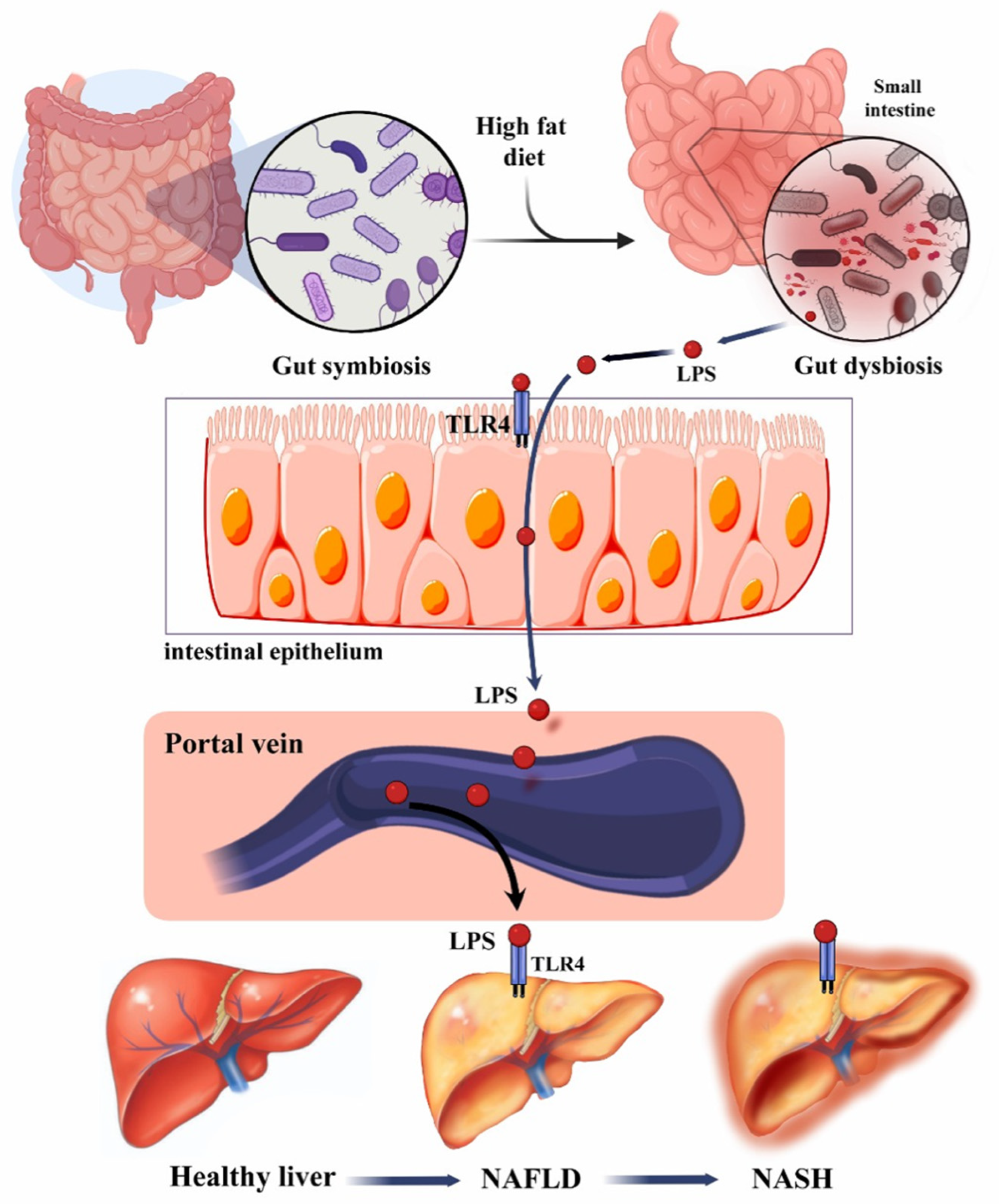 dysbiosis rosacea