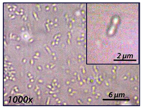 guts Ecological risks of microplastics contamination with green