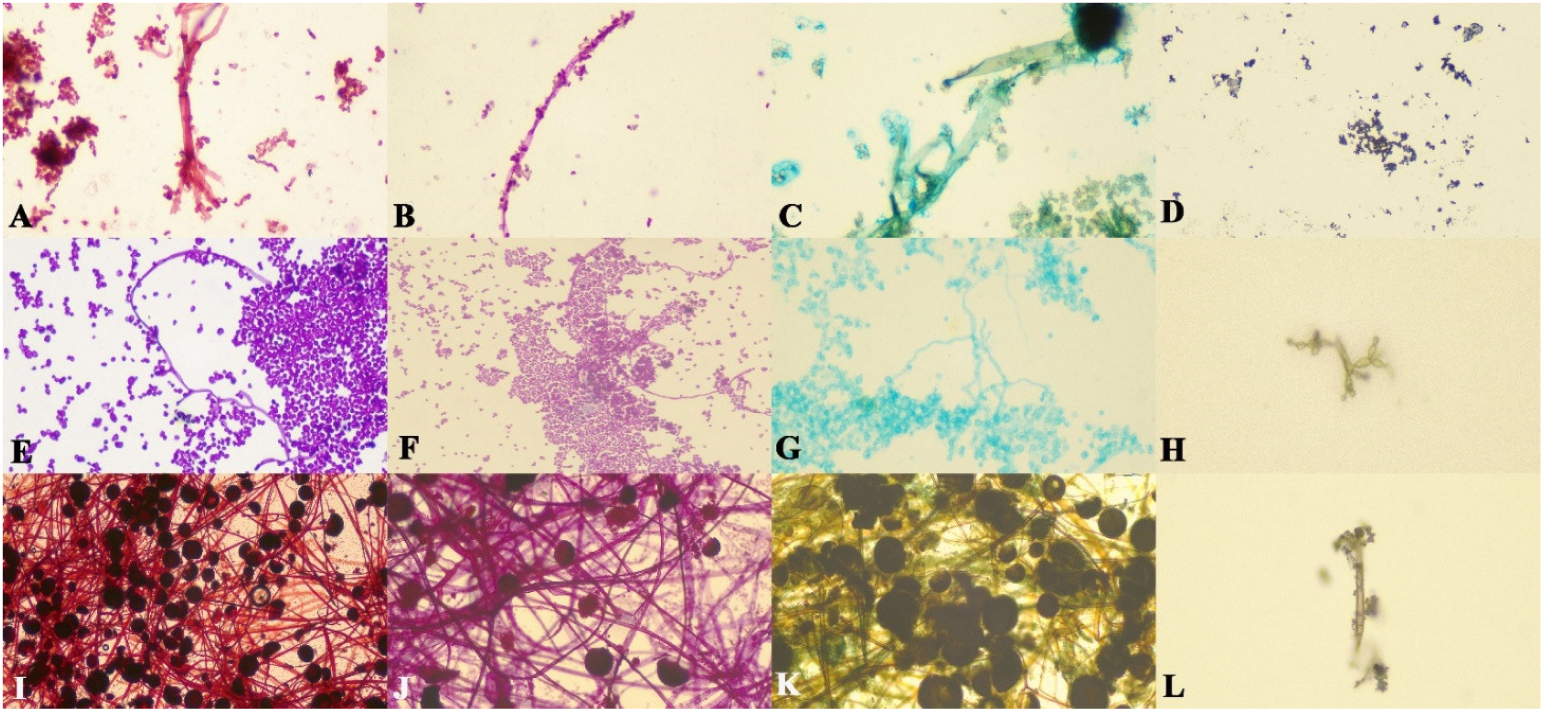 Microorganisms 10 01226 g001 550