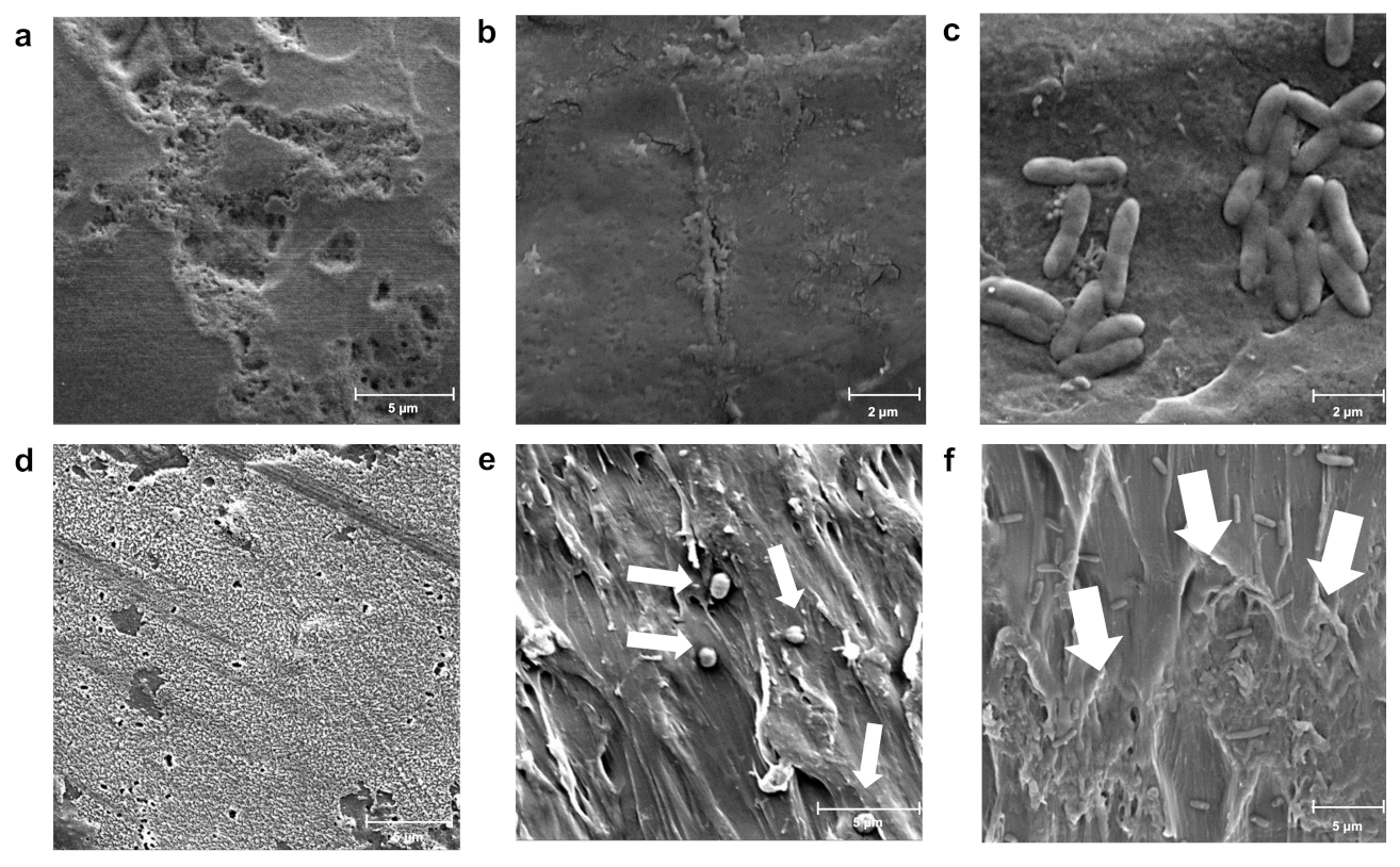 Free FullText Polystyrene Degradation by