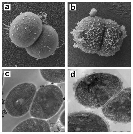 A Promising Use of Trimethyl Chitosan for Removing Microcystis ...