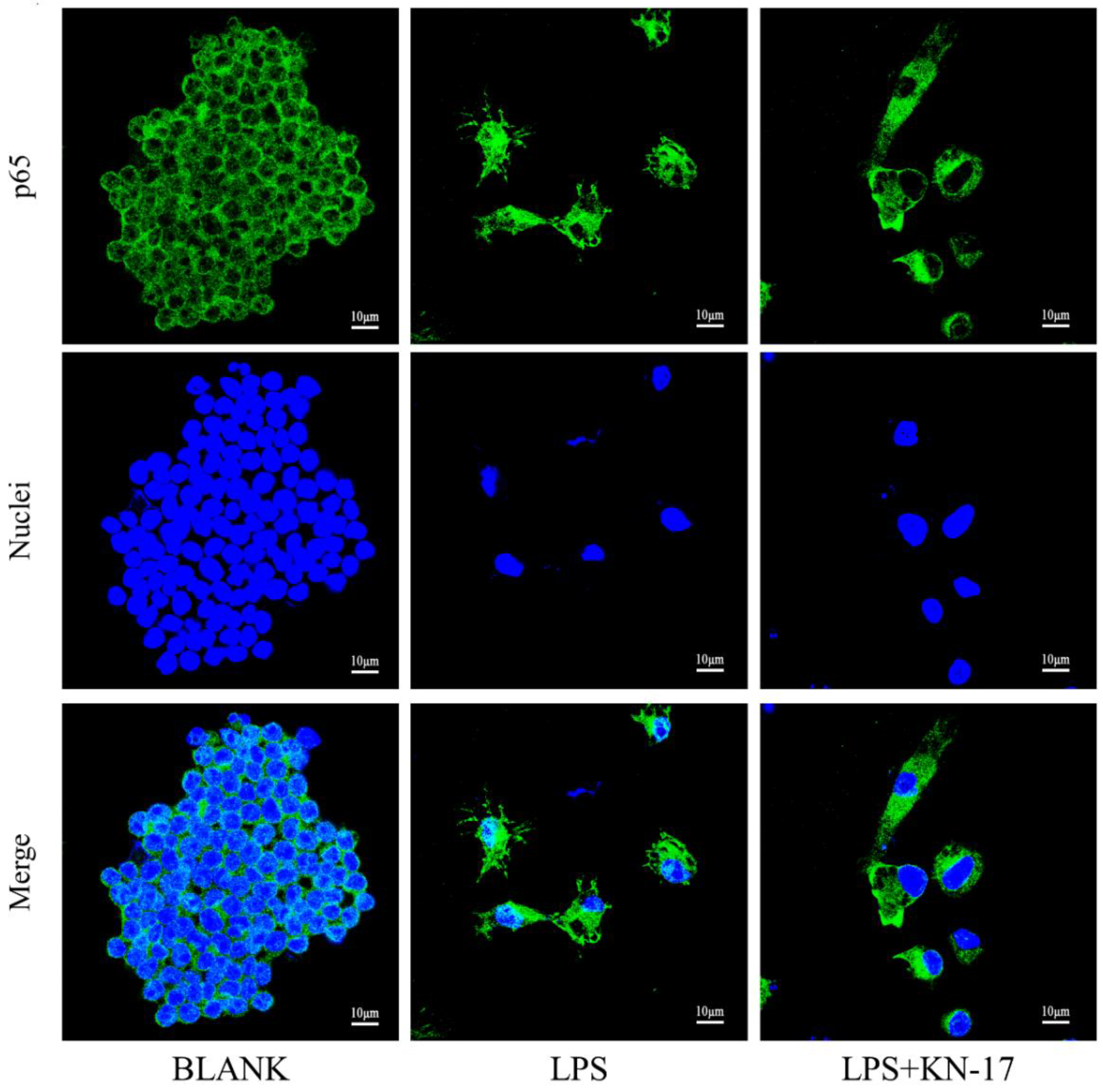 Microorganisms 10 02114 g011 Microorganisms 10 02114 g011