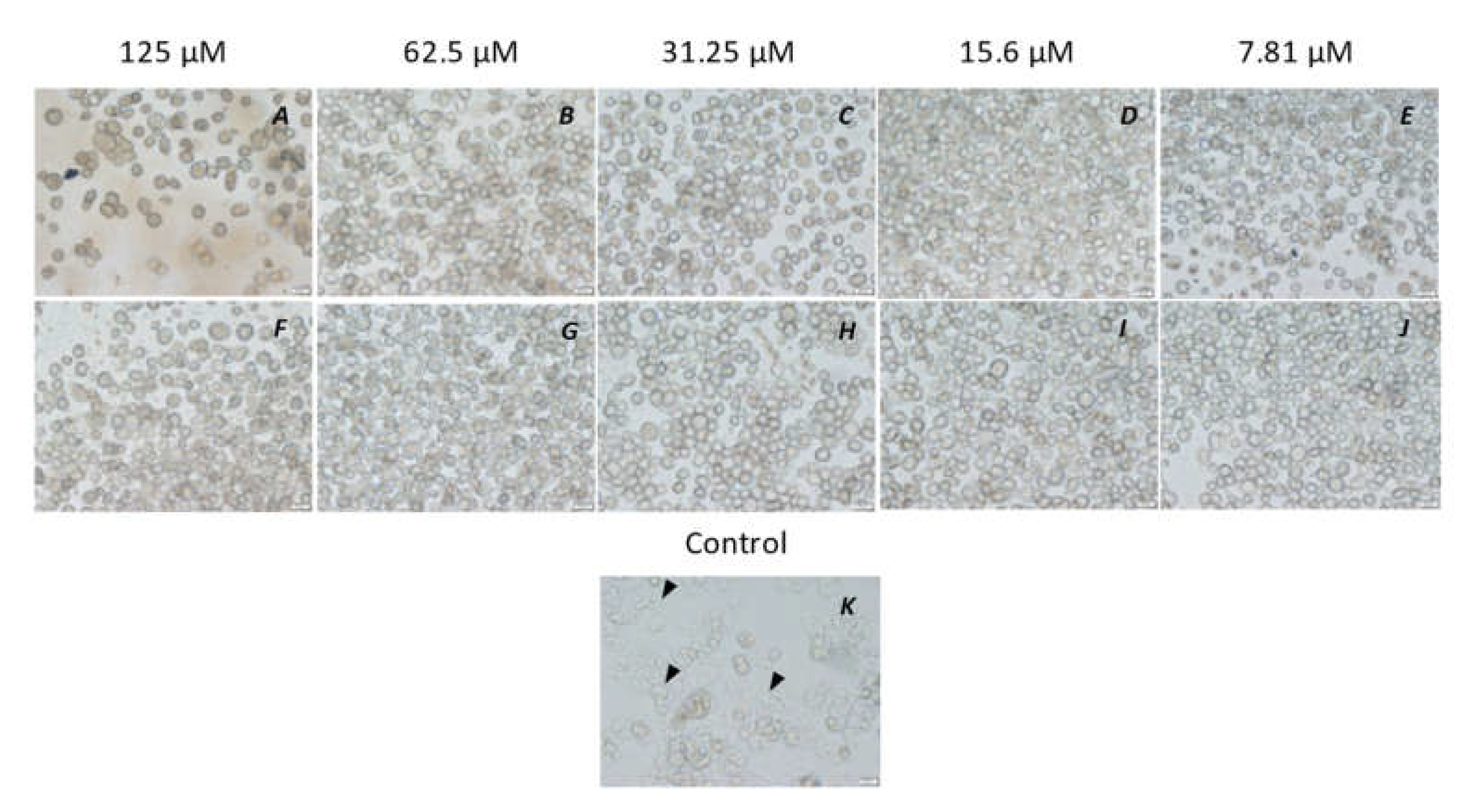 Microorganisms 10 02377 g005 Microorganisms 10 02377 g005