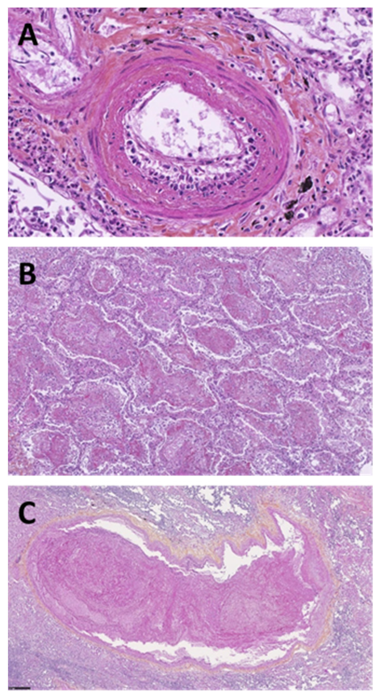 Microorganisms 10 02423 g002