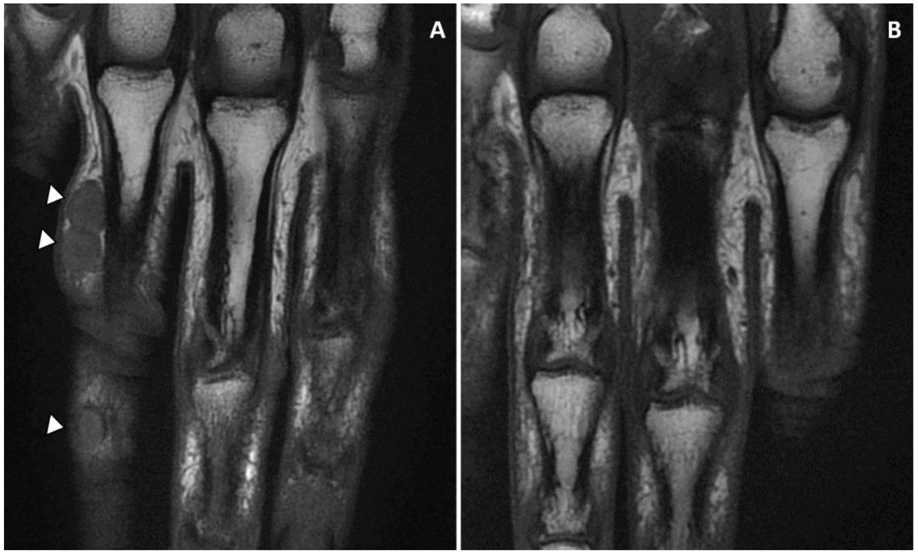 Microorganisms 11 00003 g004 Microorganisms 11 00003 g004