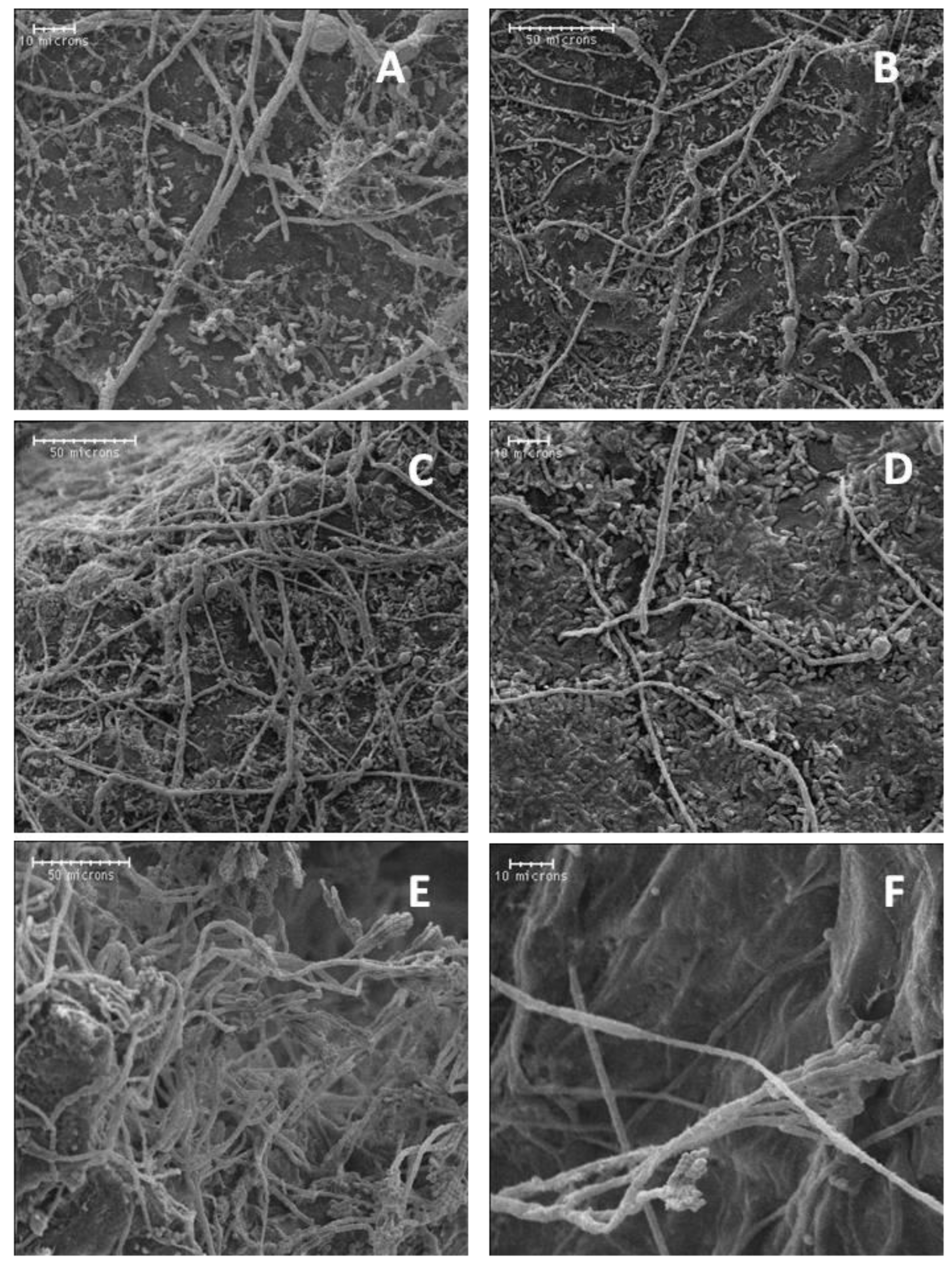 Microorganisms 11 00081 g005