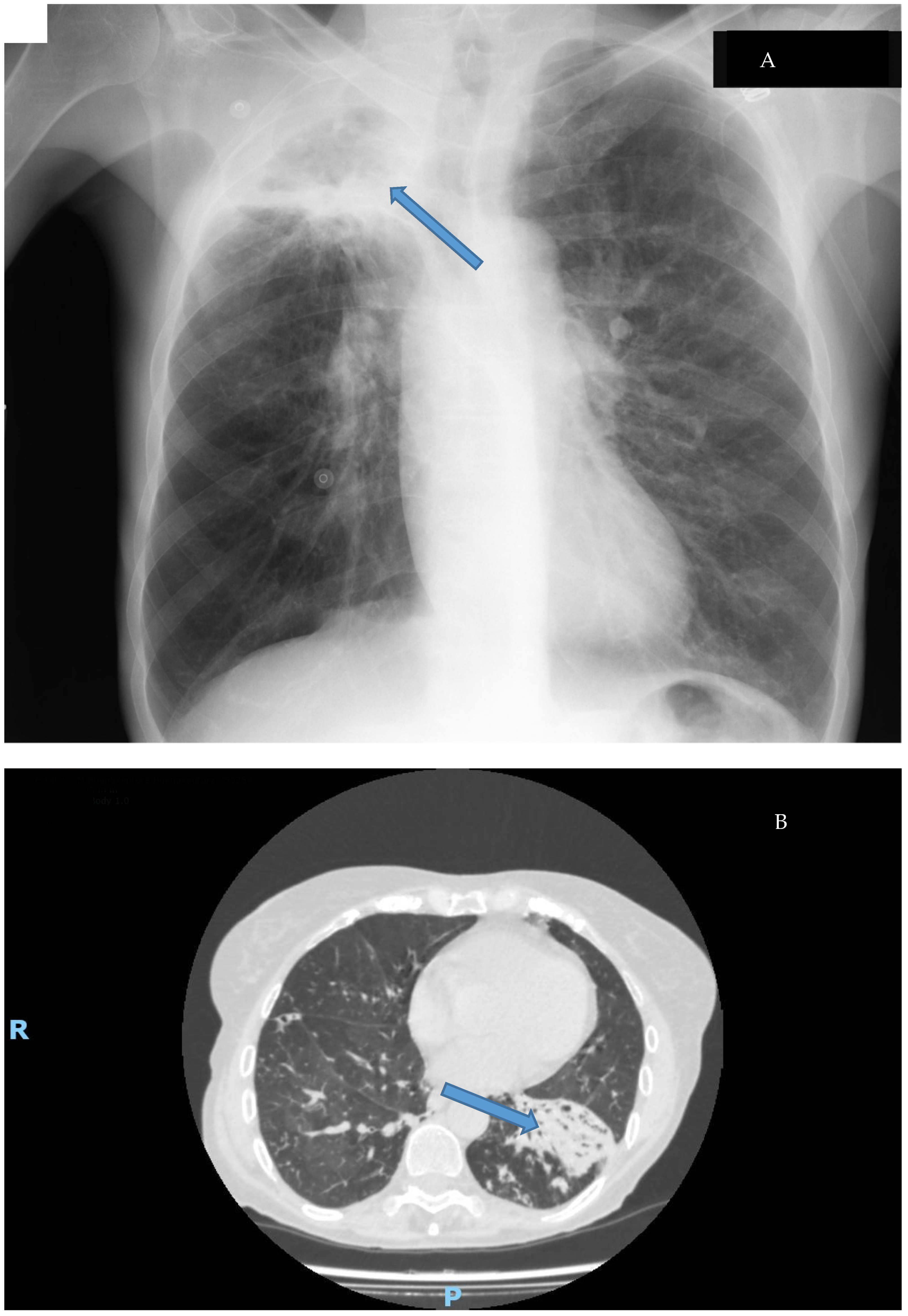 Microorganisms 11 00090 g004 Microorganisms 11 00090 g004
