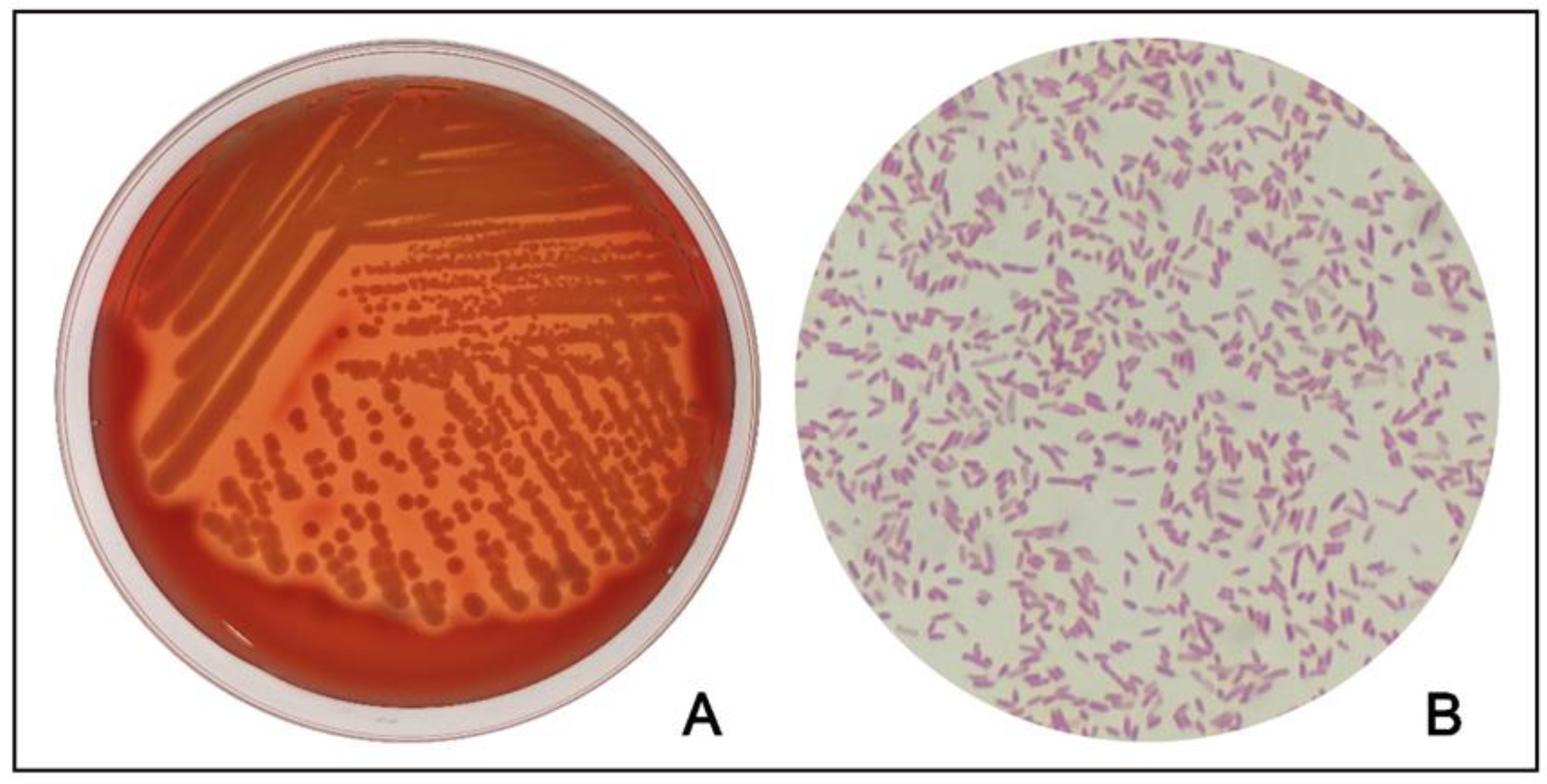 Microorganisms 11 00333 g003 Microorganisms 11 00333 g003