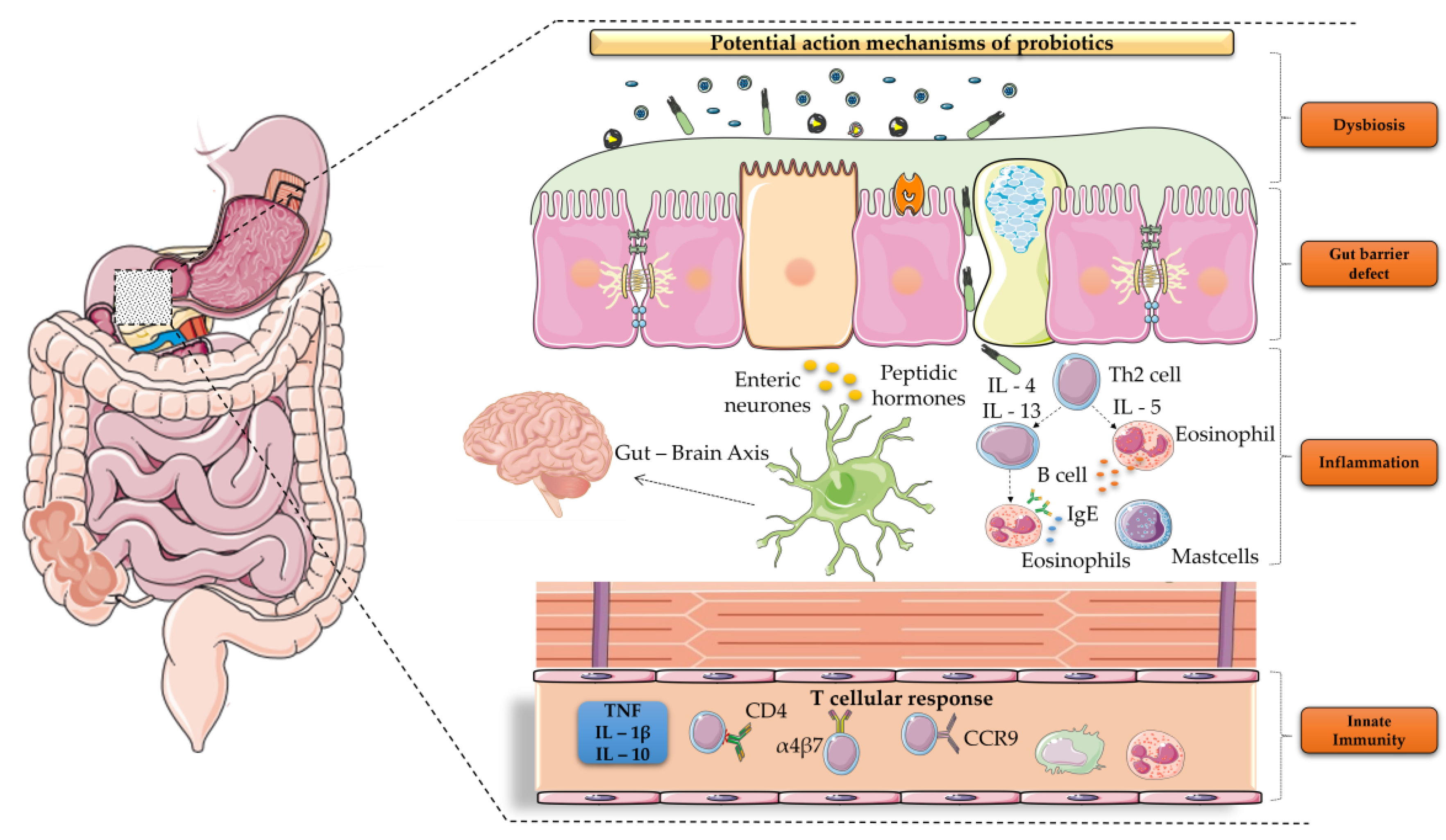 Free FullText Probiotics in Functional Dyspepsia