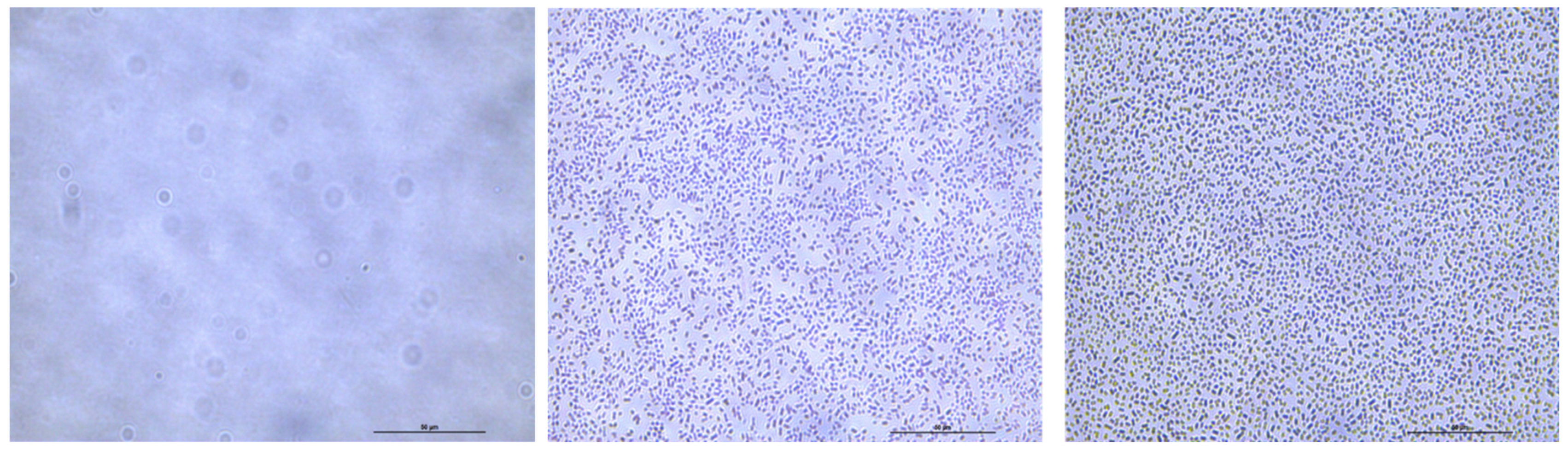 Microorganisms 11 00443 g006