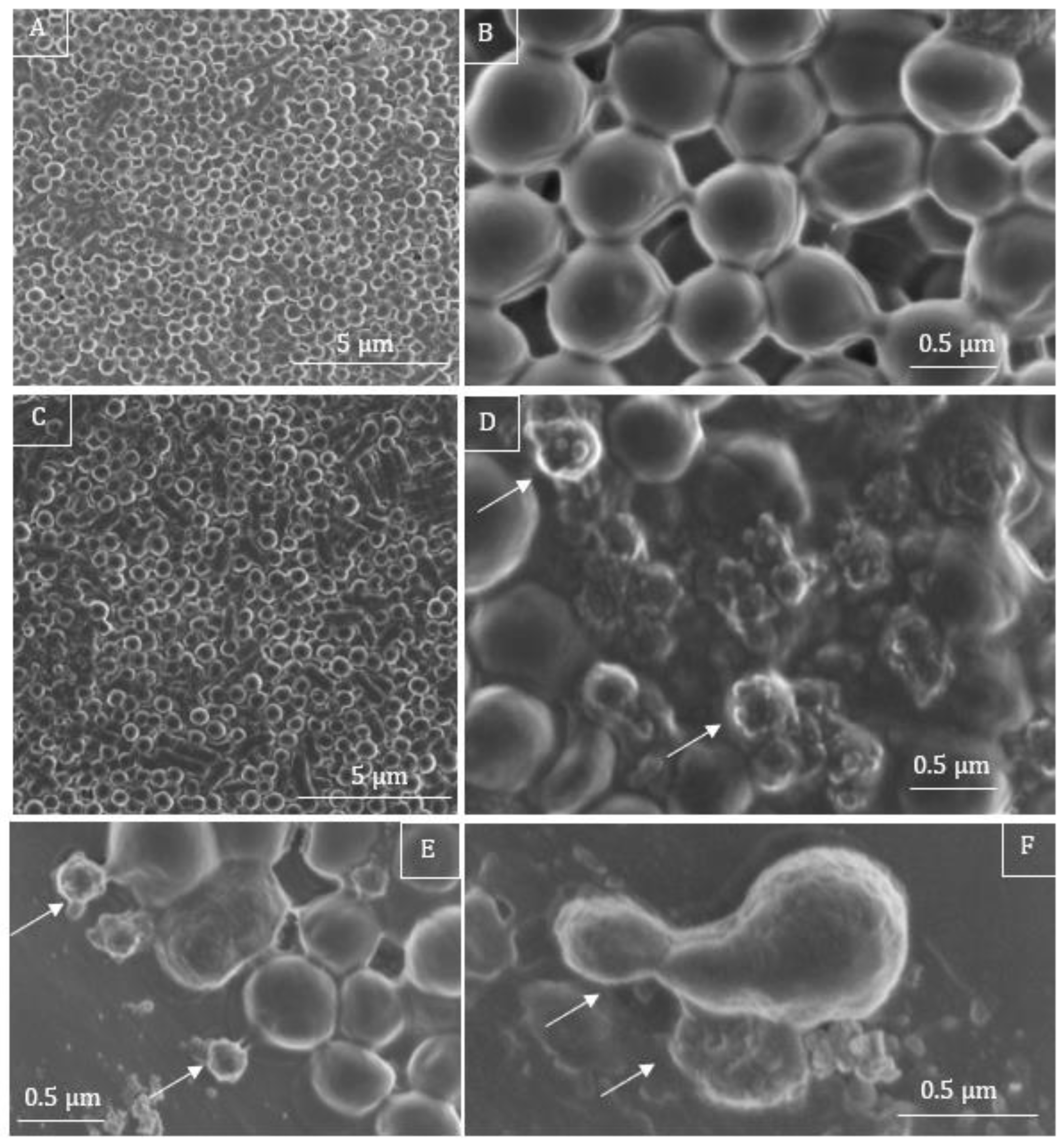 Microorganisms 11 00495 g008 Microorganisms 11 00495 g008