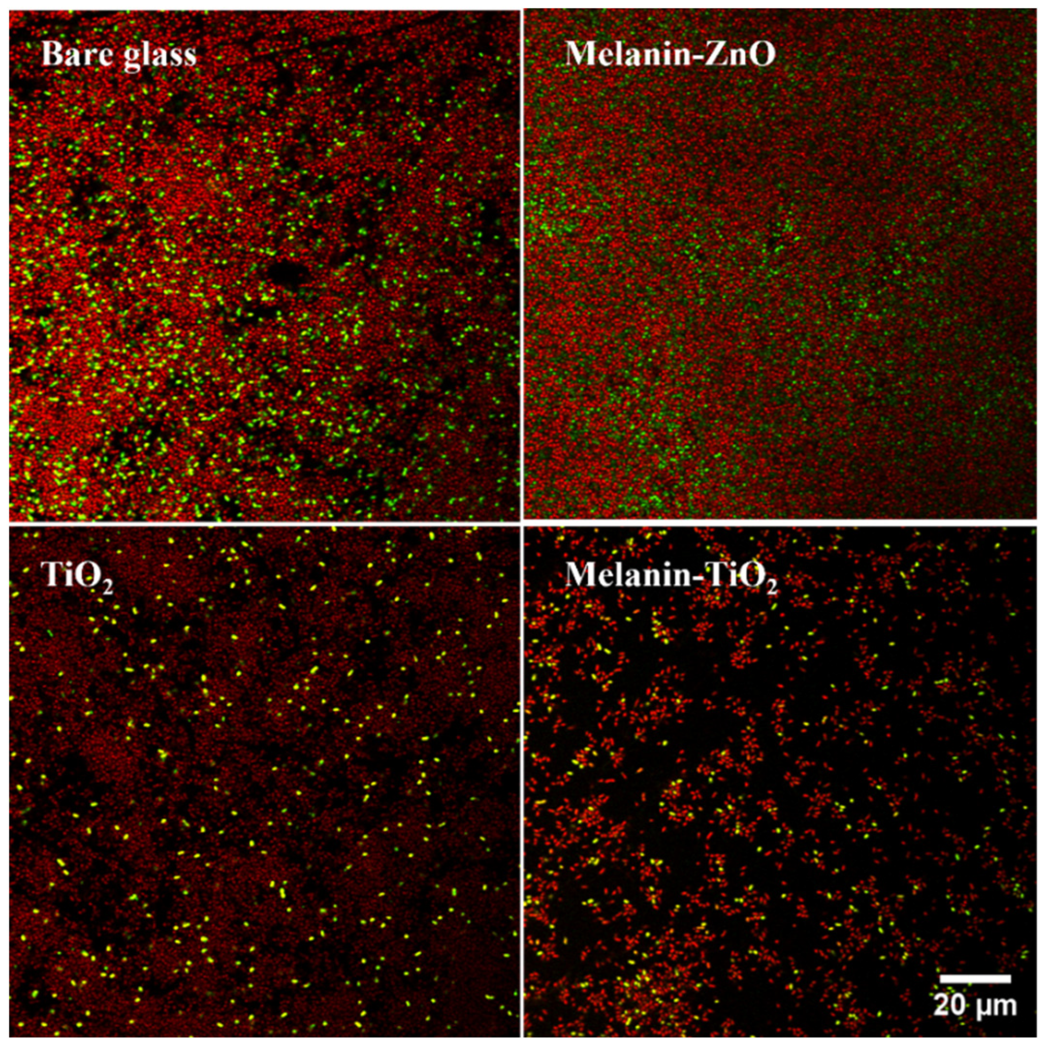 Microorganisms 11 00621 g004 Microorganisms 11 00621 g004