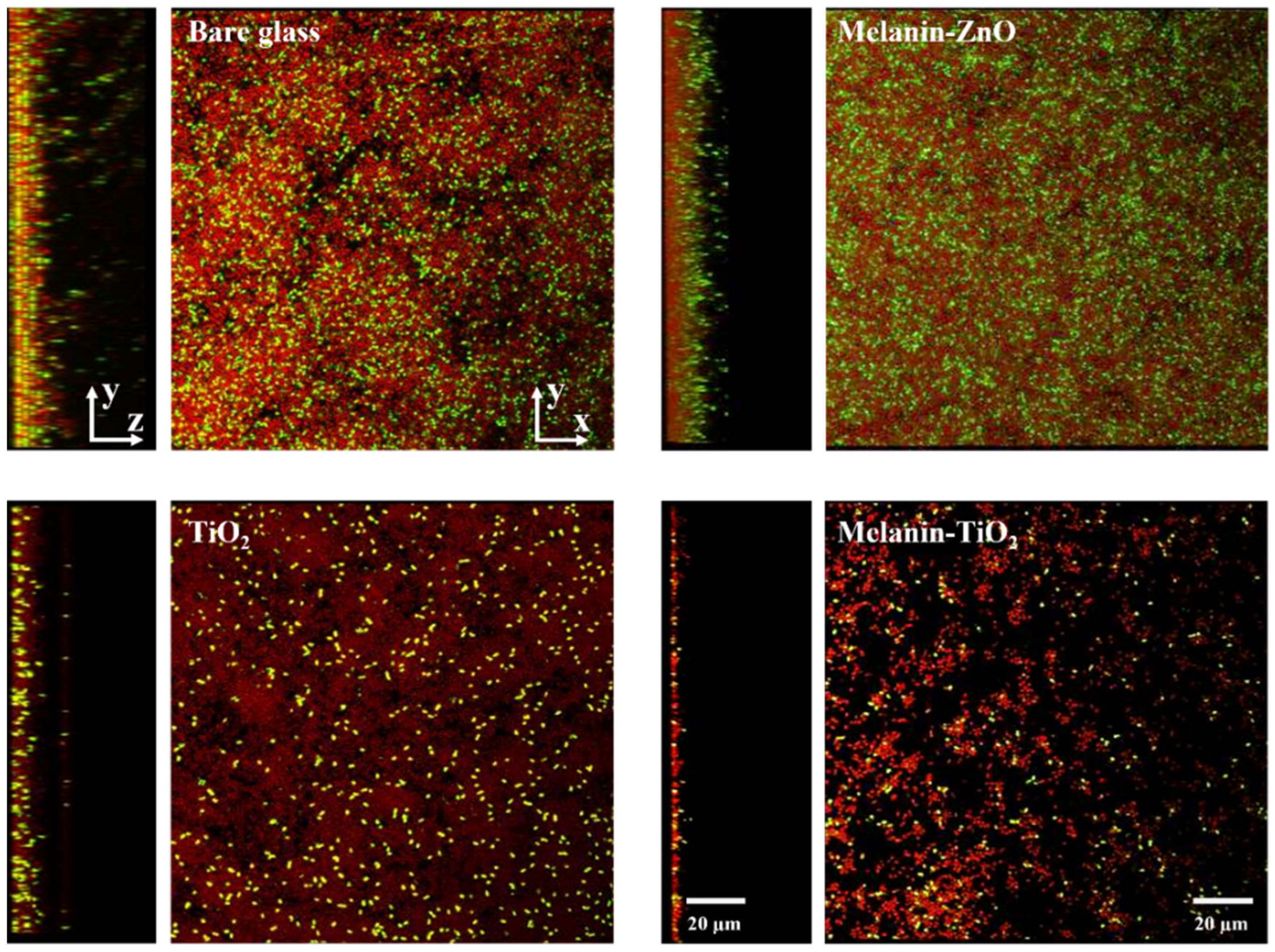 Microorganisms 11 00621 g005 Microorganisms 11 00621 g005