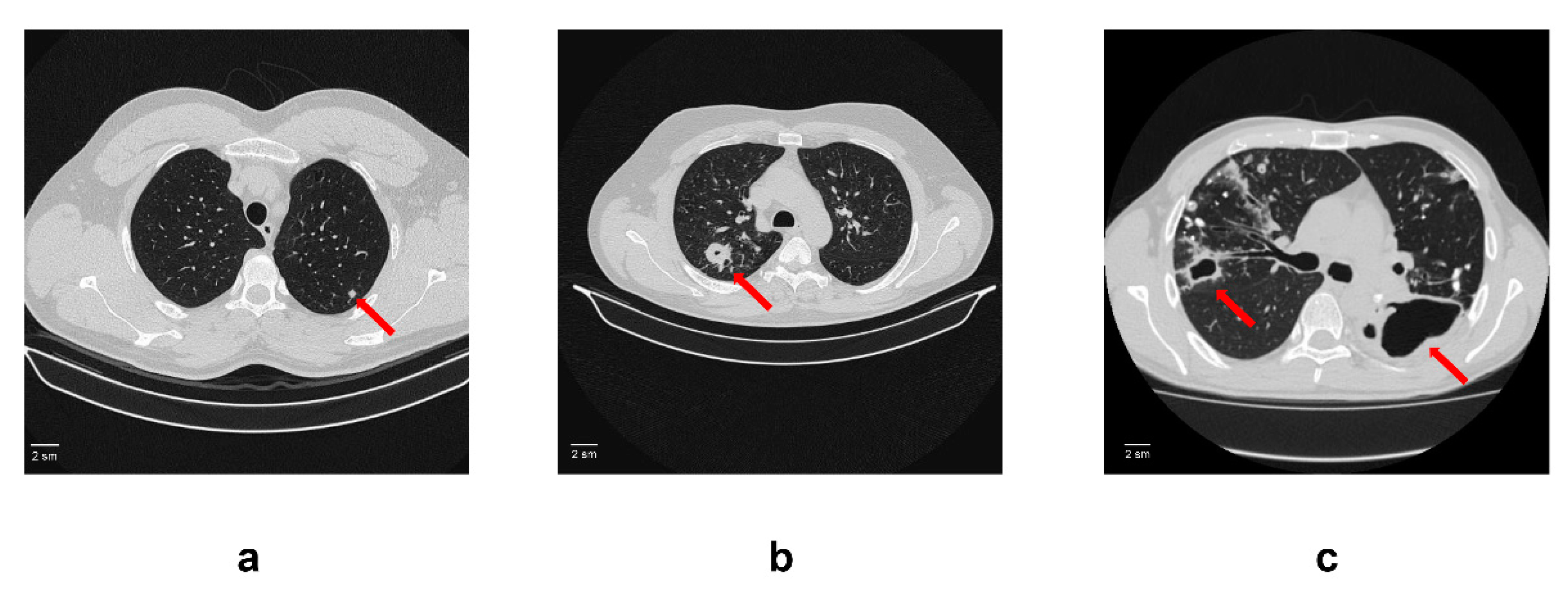 Microorganisms 11 00626 g001