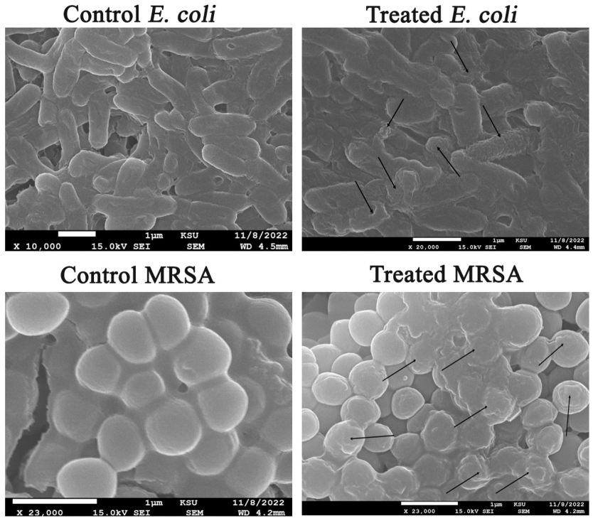 Microorganisms 11 00645 g012 Microorganisms 11 00645 g012