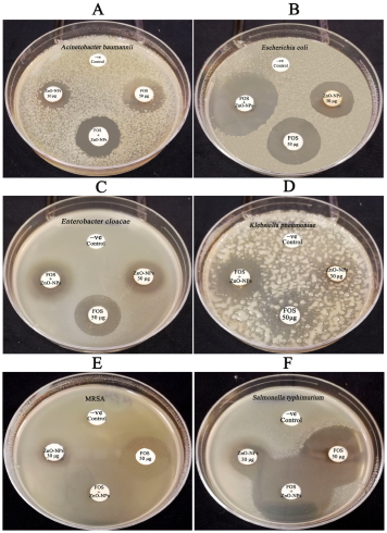 Microorganisms 11 00645 g013 Microorganisms 11 00645 g013