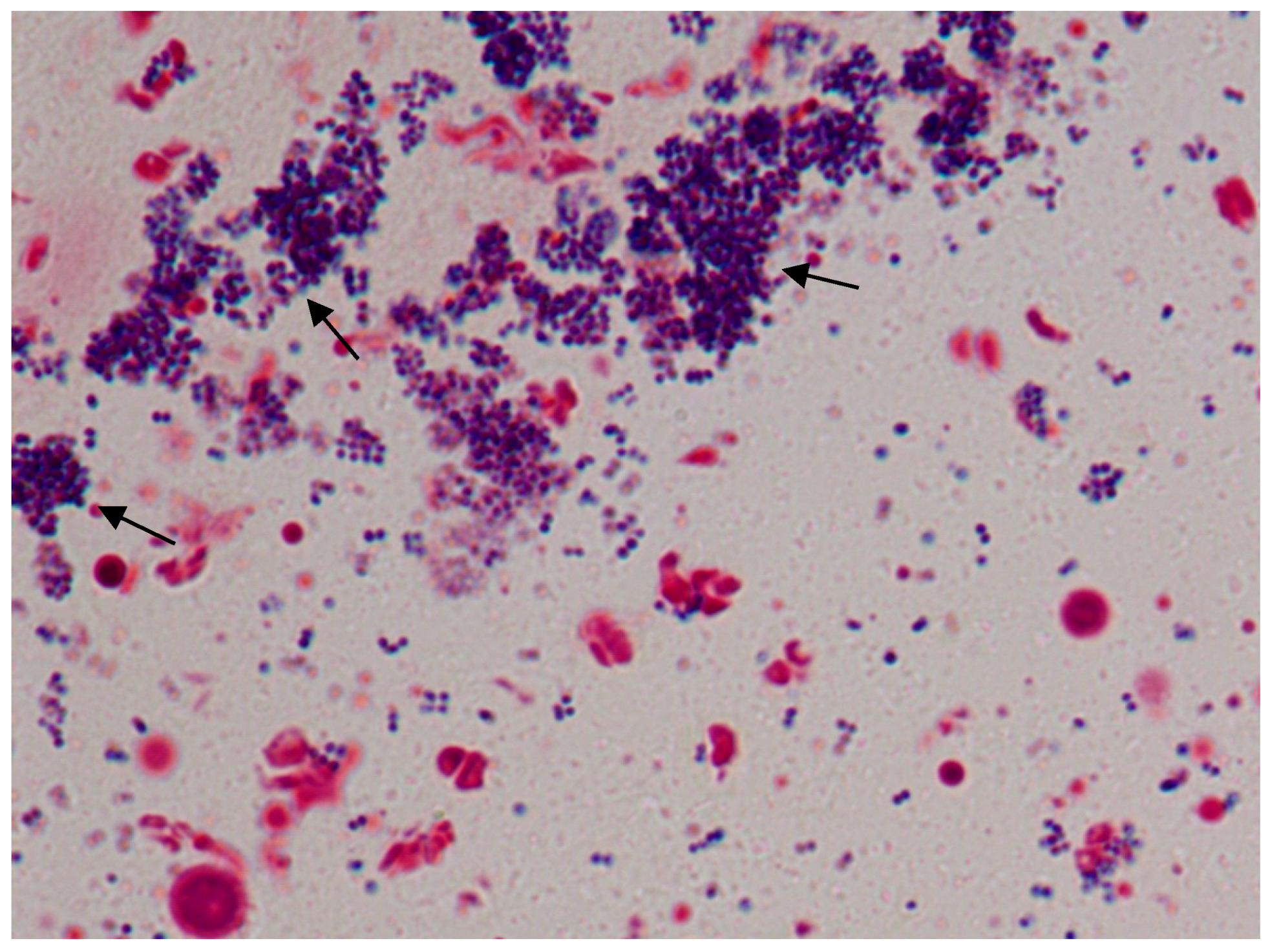 Microorganisms 11 00692 g005