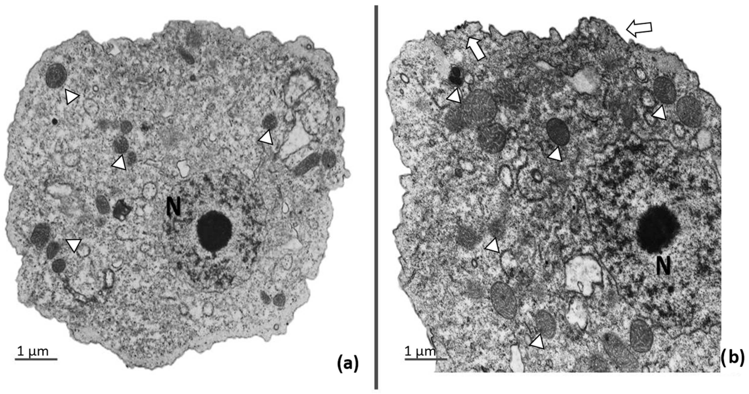 Microorganisms 11 00708 g004