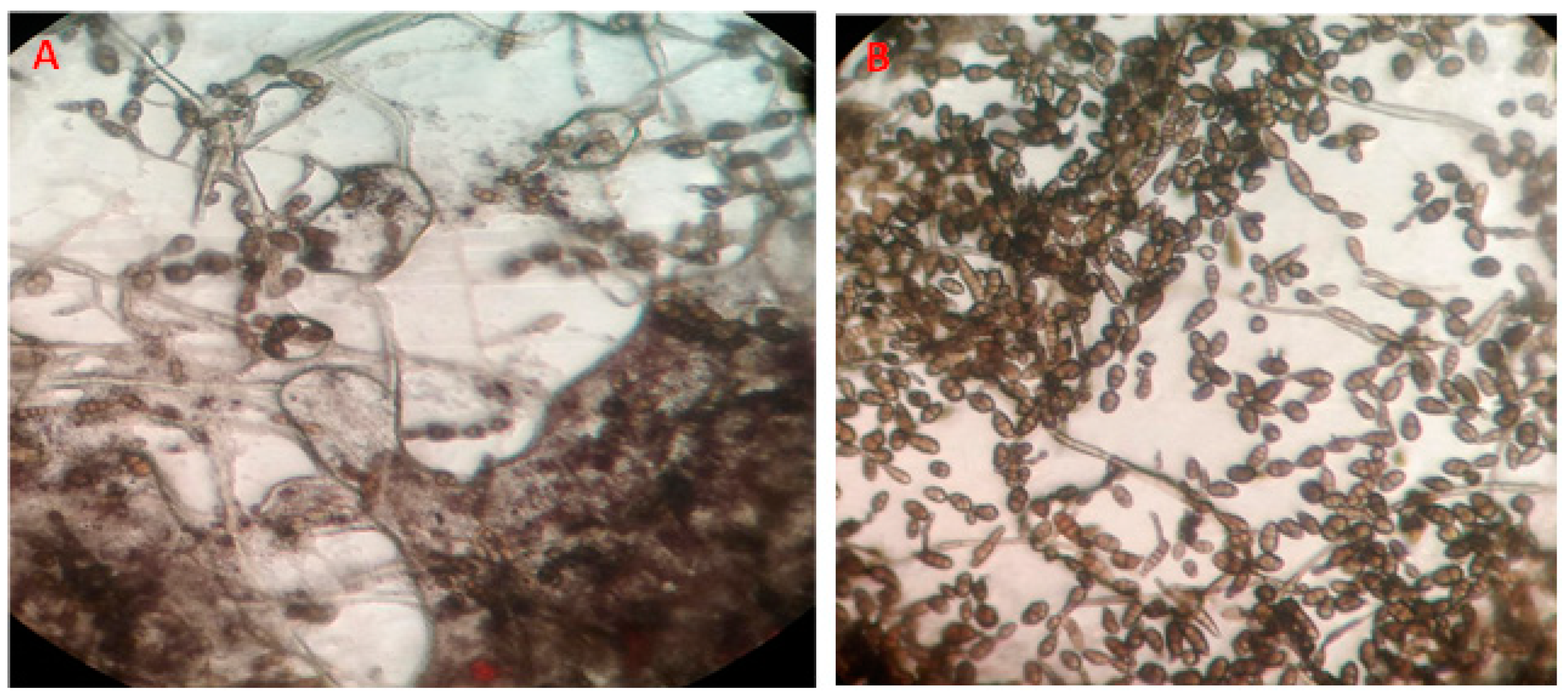 Microorganisms 11 00728 g004 Microorganisms 11 00728 g004