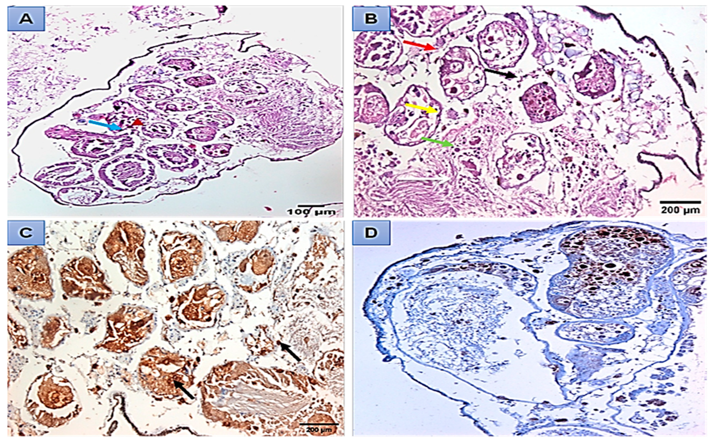 Microorganisms 11 00811 g006
