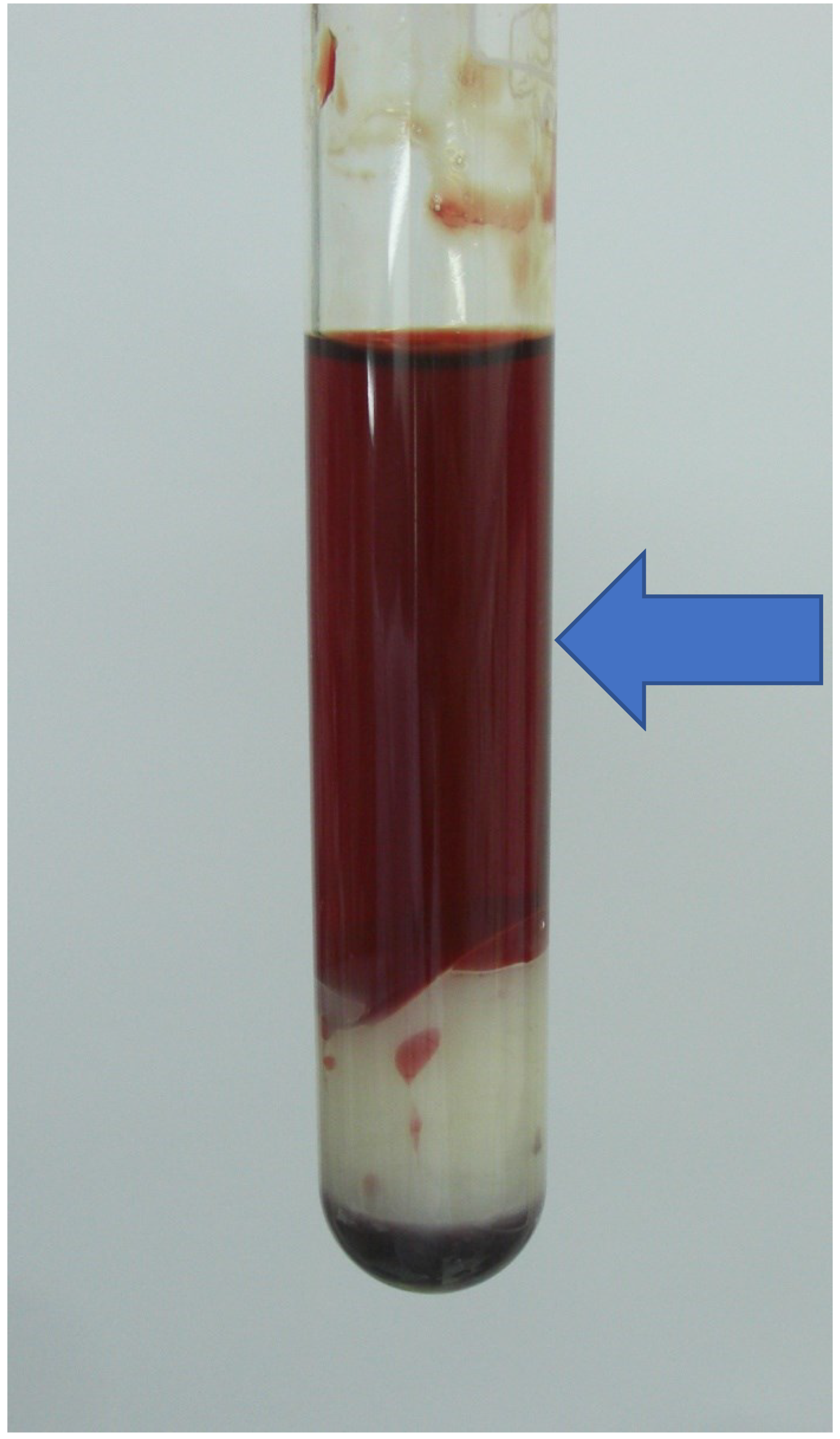 Free FullText Clinical and Microbiological Features
