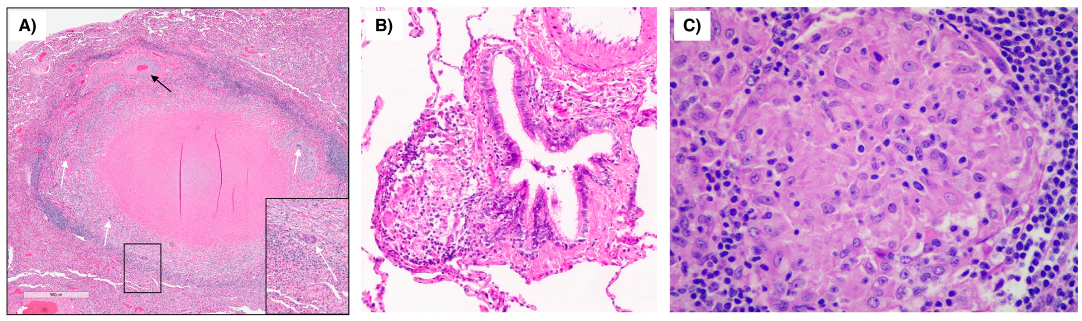 Microorganisms 11 00829 g001
