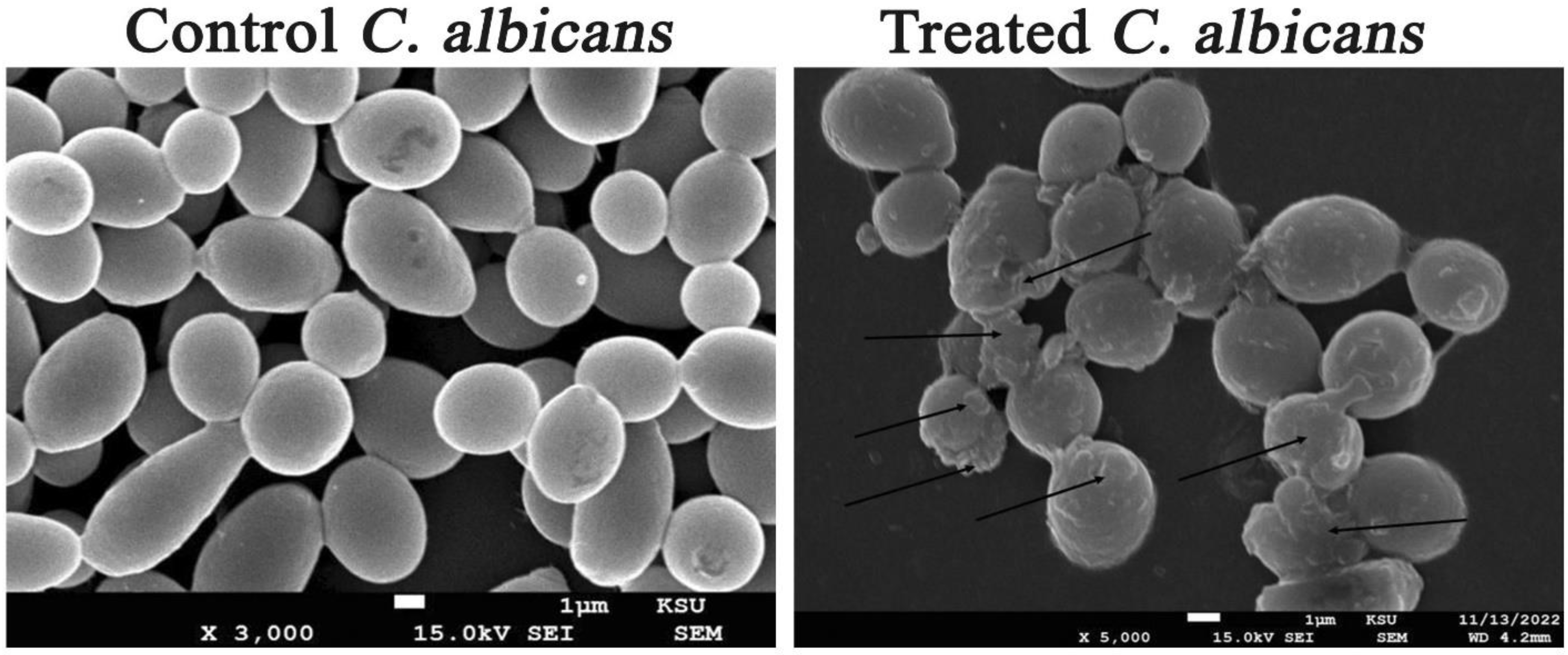 Microorganisms 11 00945 g011