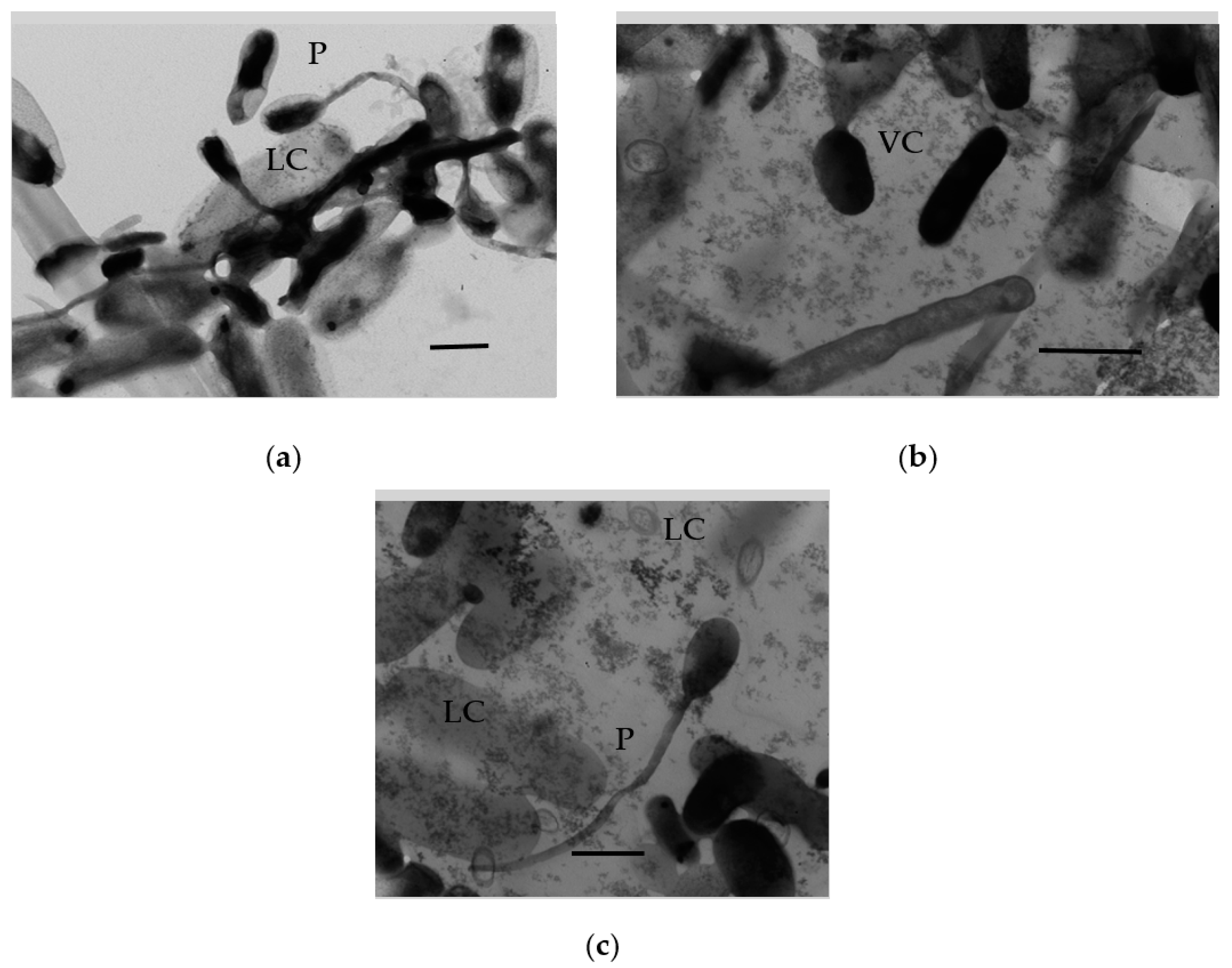 Microorganisms 11 01133 g009 Microorganisms 11 01133 g009