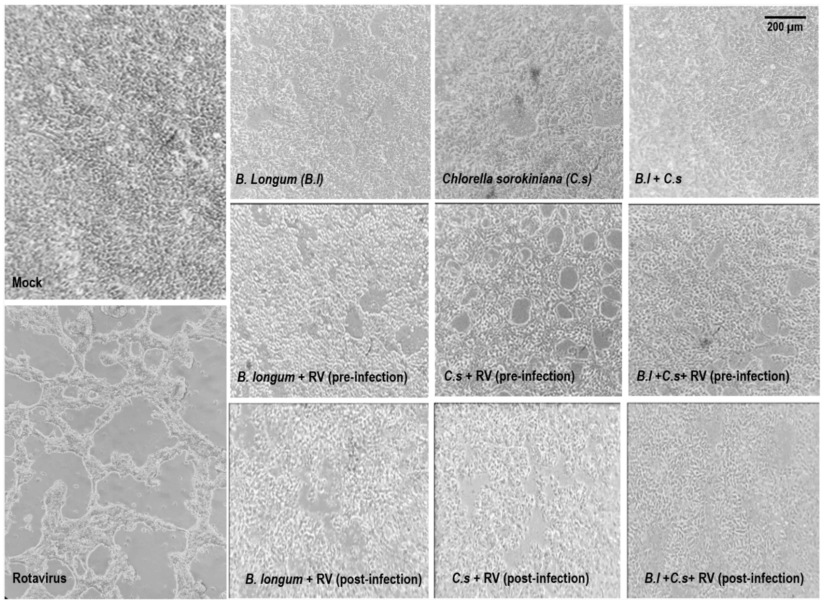 Microorganisms 11 01237 g001