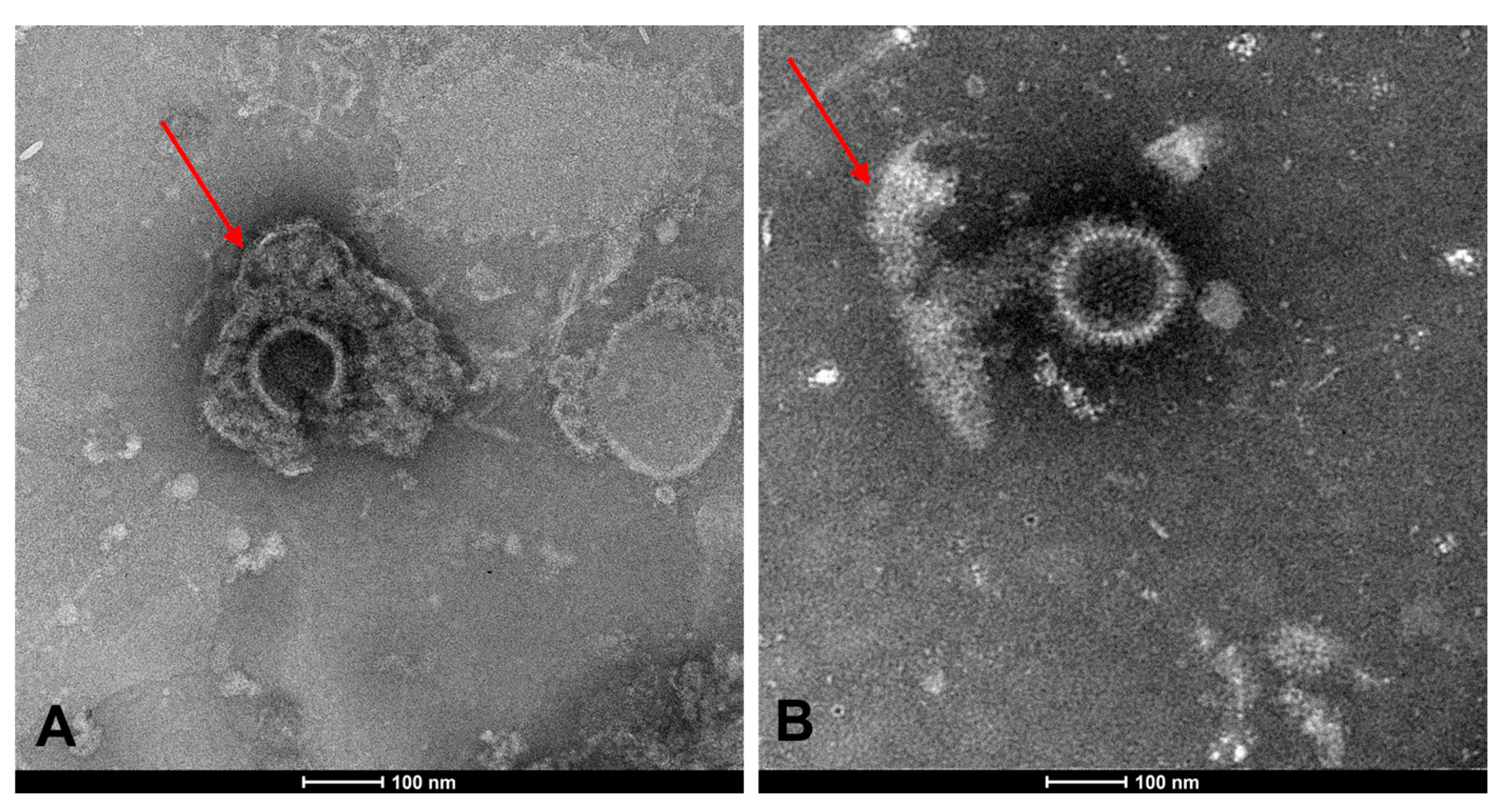 Microorganisms 11 01346 g005 Microorganisms 11 01346 g005