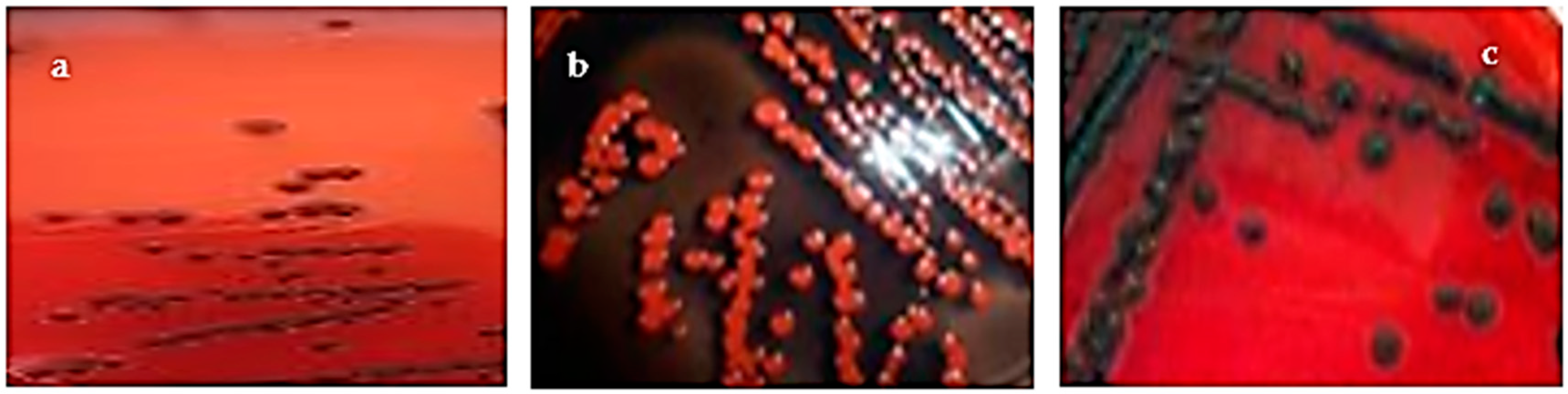 Microorganisms 11 01353 g001