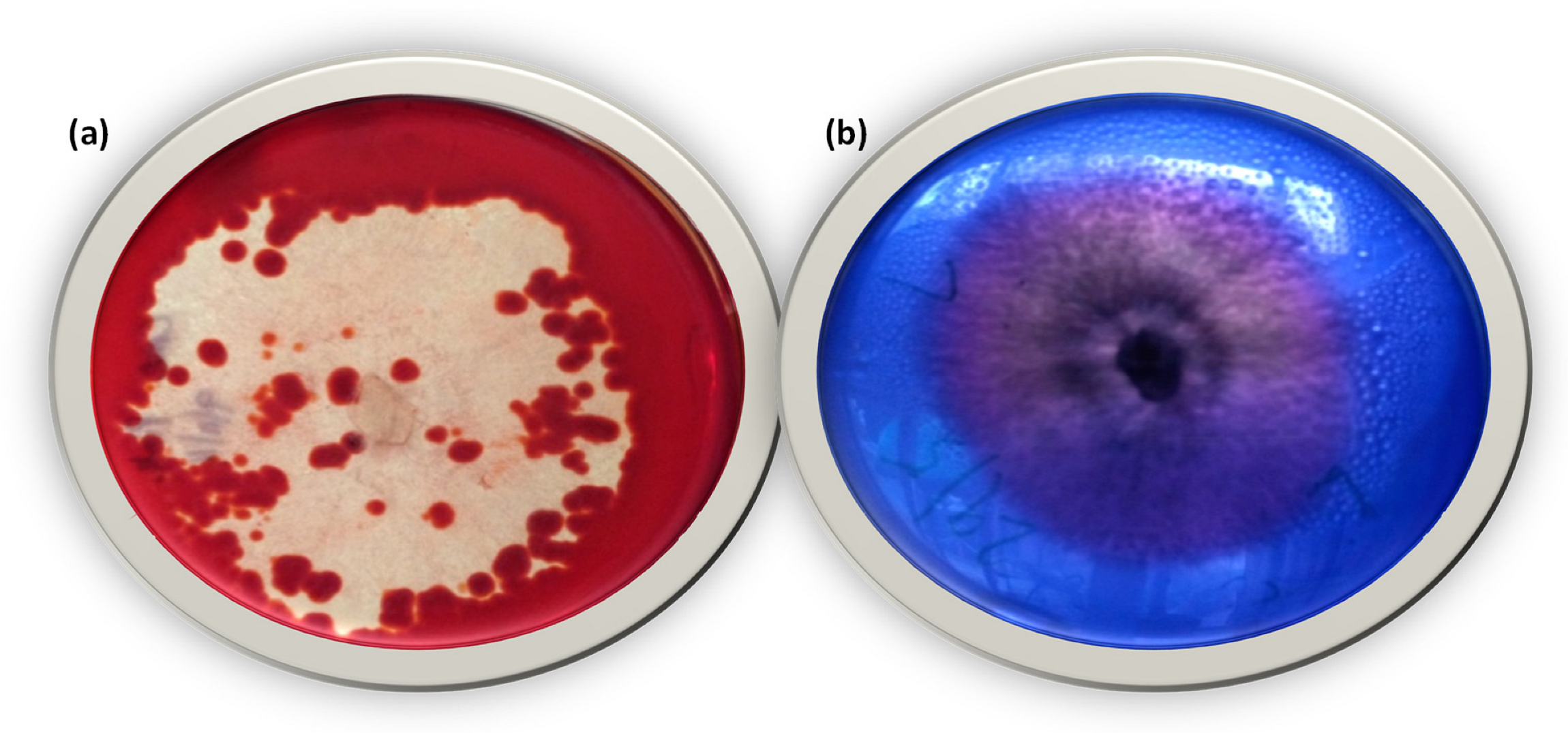 Microorganisms 11 01435 g004 Microorganisms 11 01435 g004