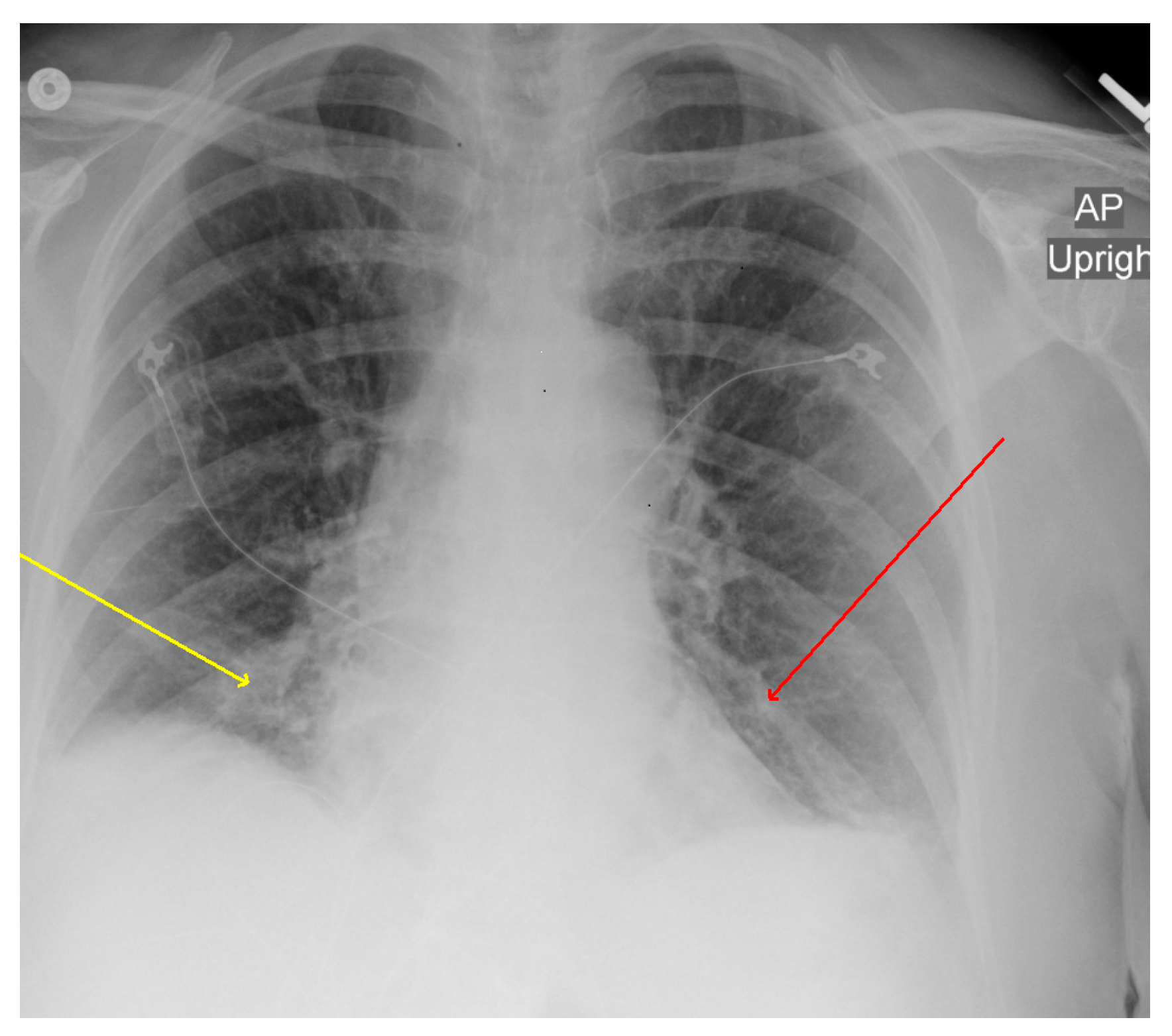 Microorganisms 11 01483 g001 Microorganisms 11 01483 g001